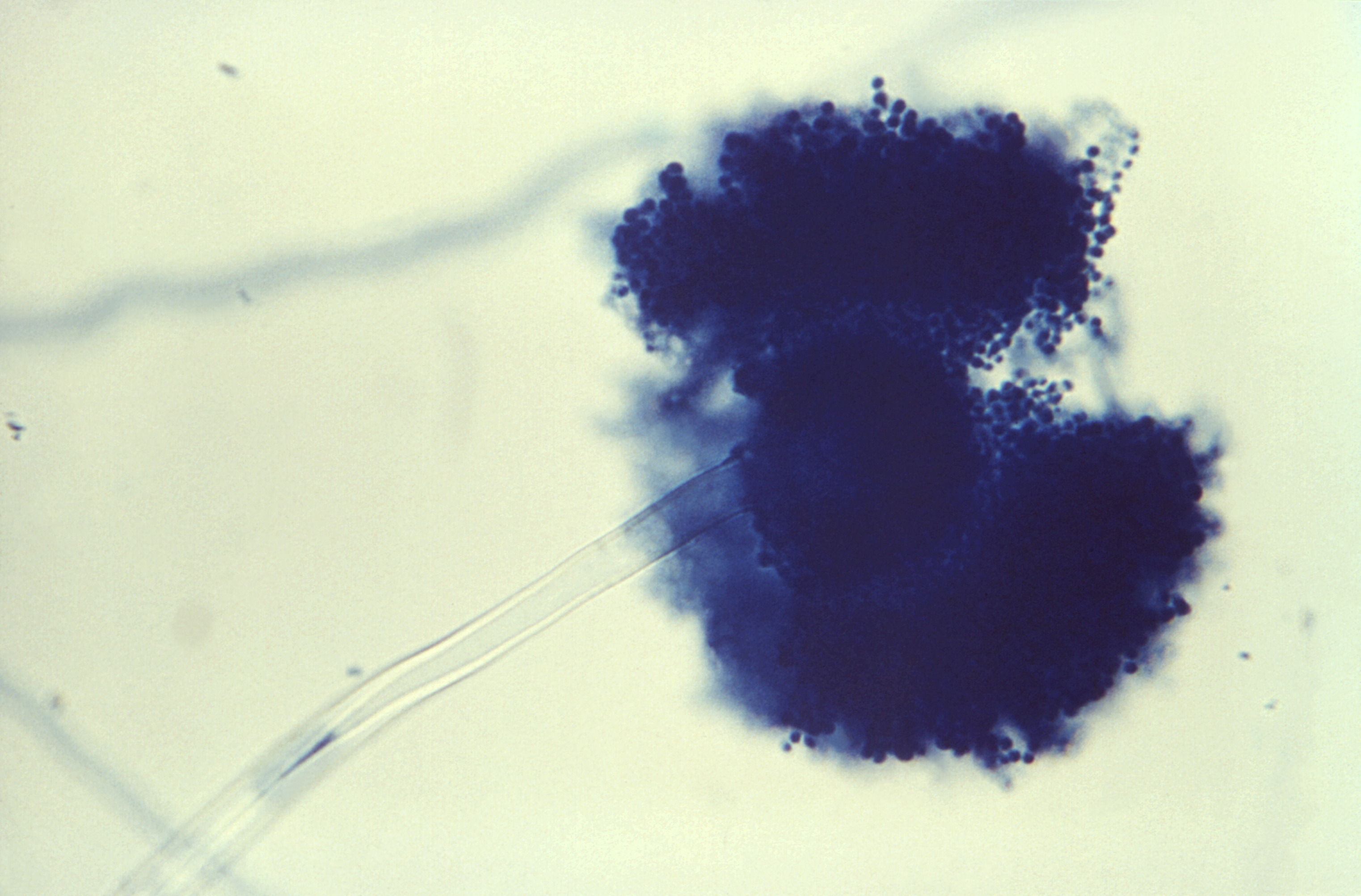 Aspergillus alliaceus Fuente: Public Health Image Library CDC