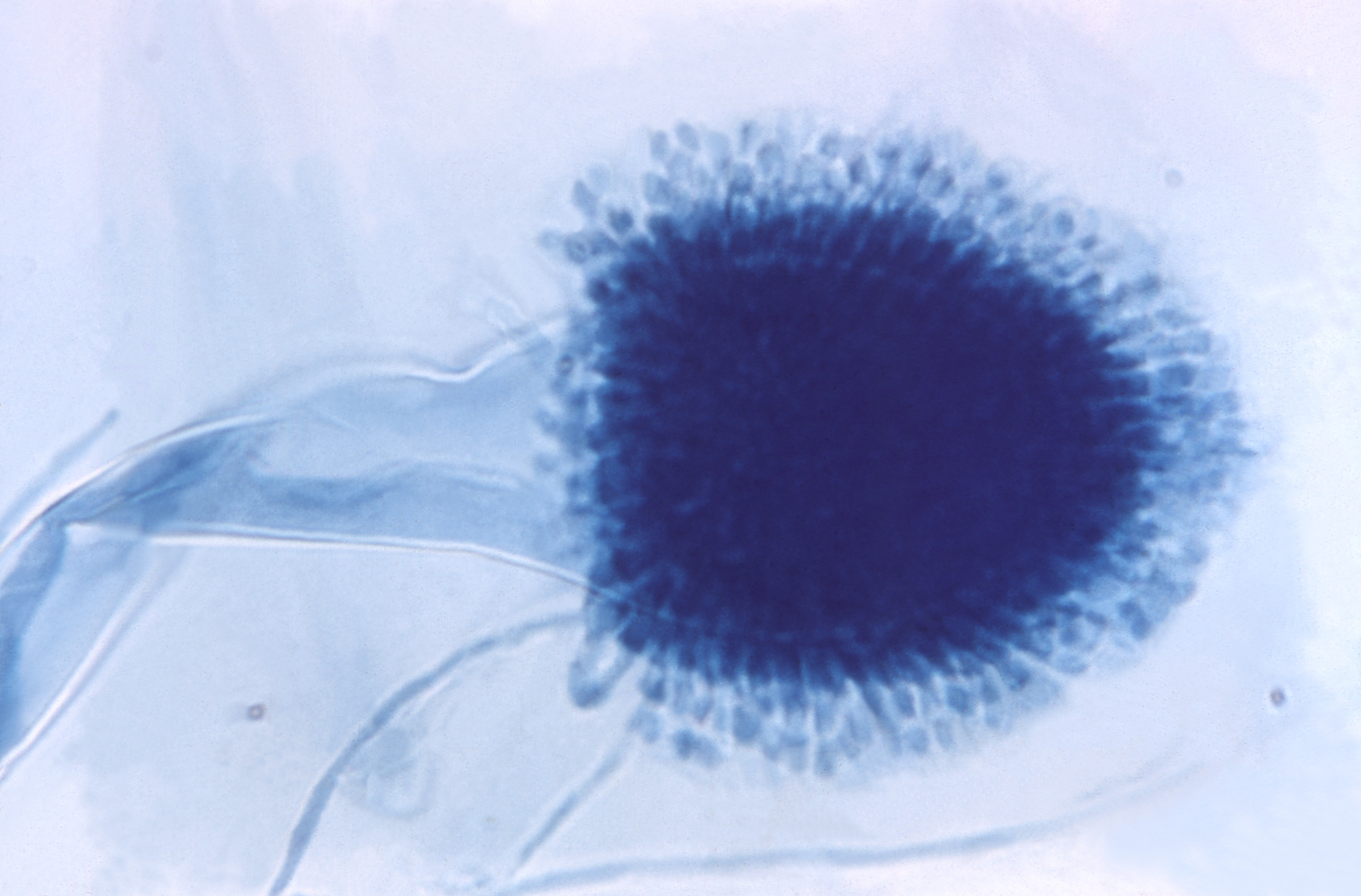 Aspergillus clavatus (23080) Fuente: Public Health Image Library CDC