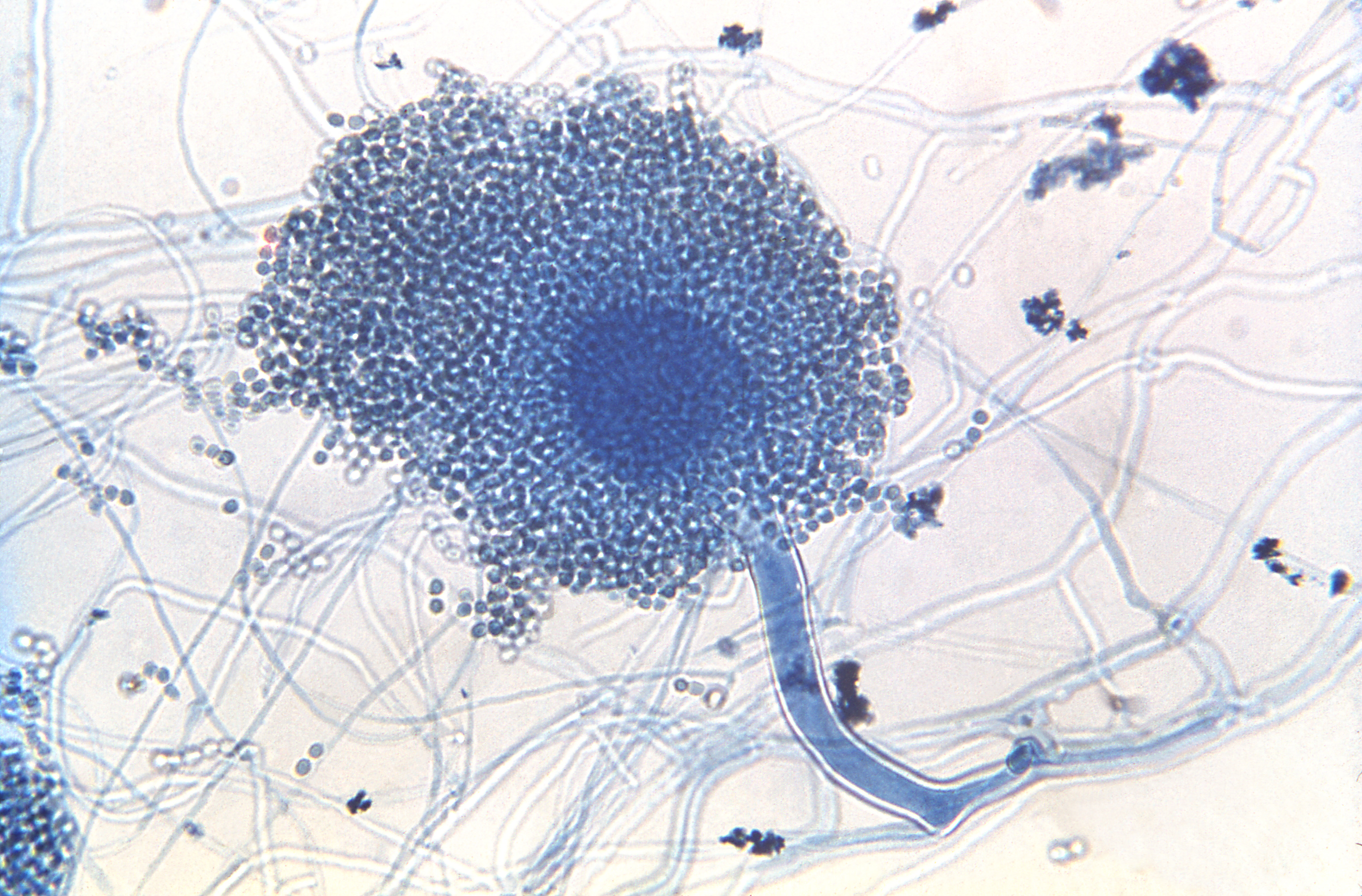 Aspergillus clavatus (23087) Fuente: Public Health Image Library CDC