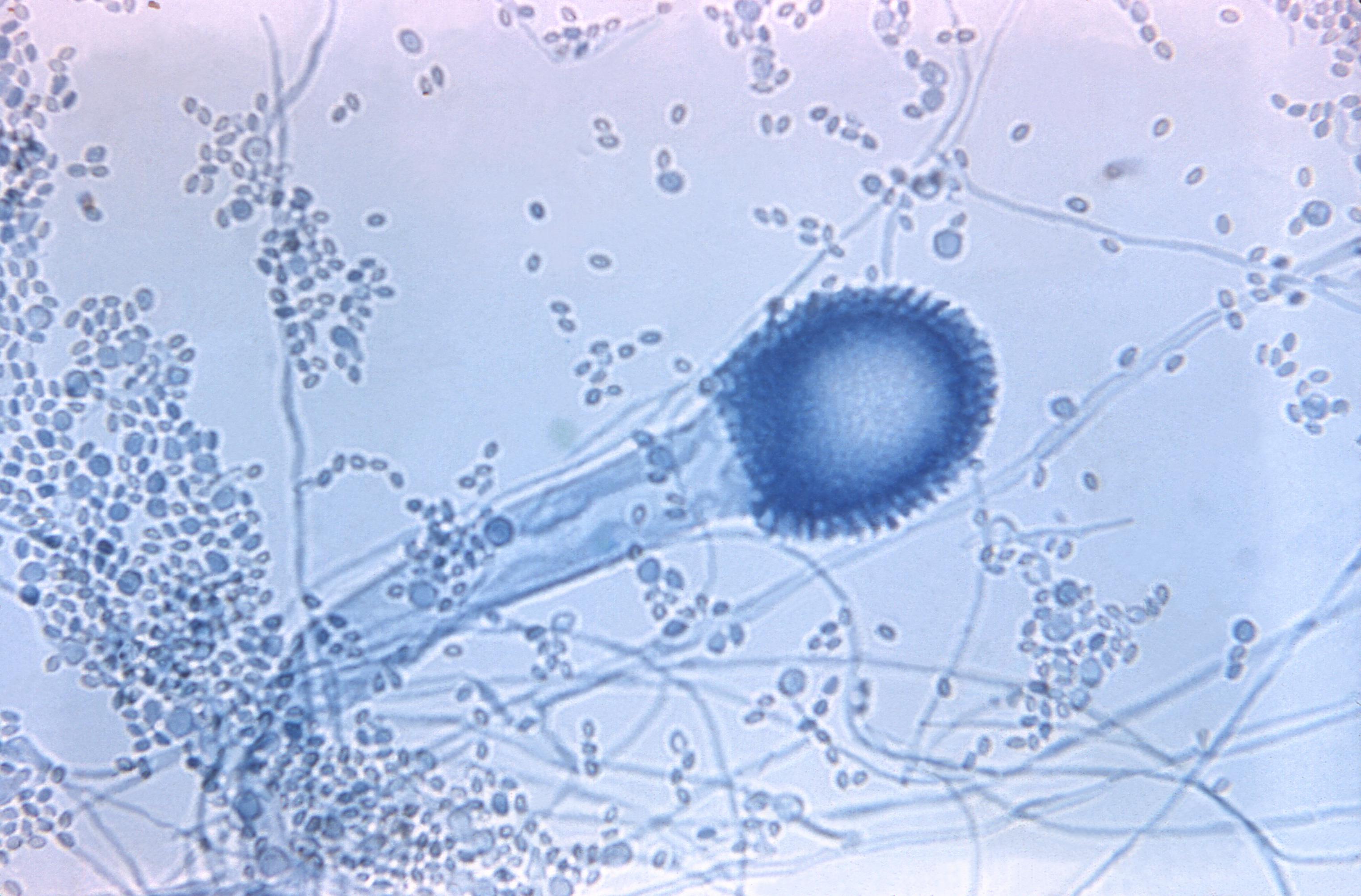 Aspergillus clavatus Fuente: Public Health Image Library CDC