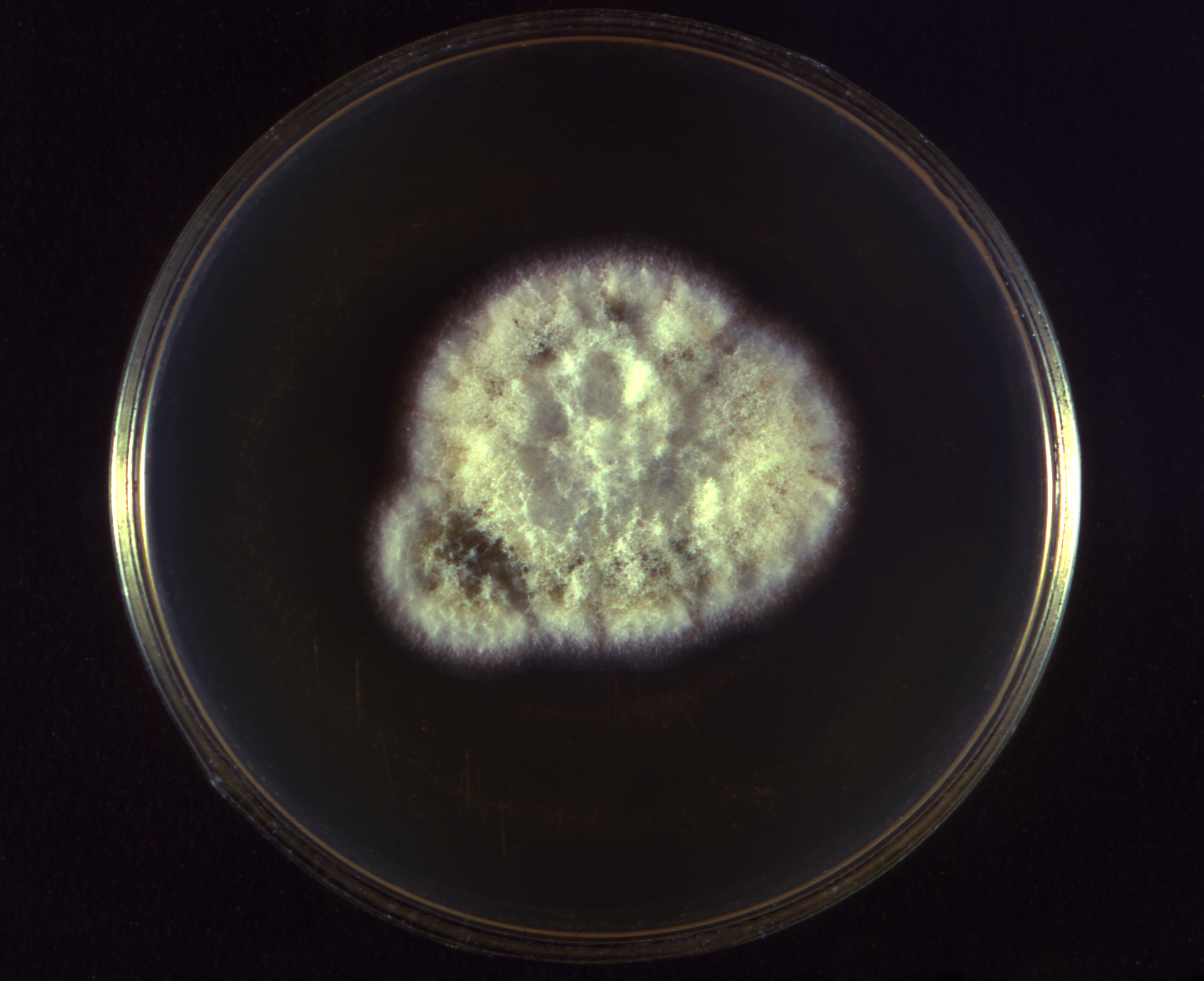 Aspergillus flavus (21720) Fuente: Public Health Image Library CDC