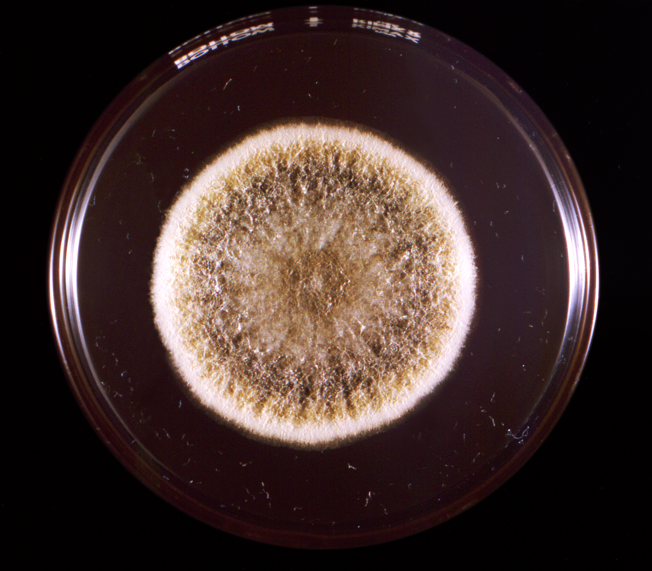 Aspergillus flavus Fuente: Public Health Image Library CDC