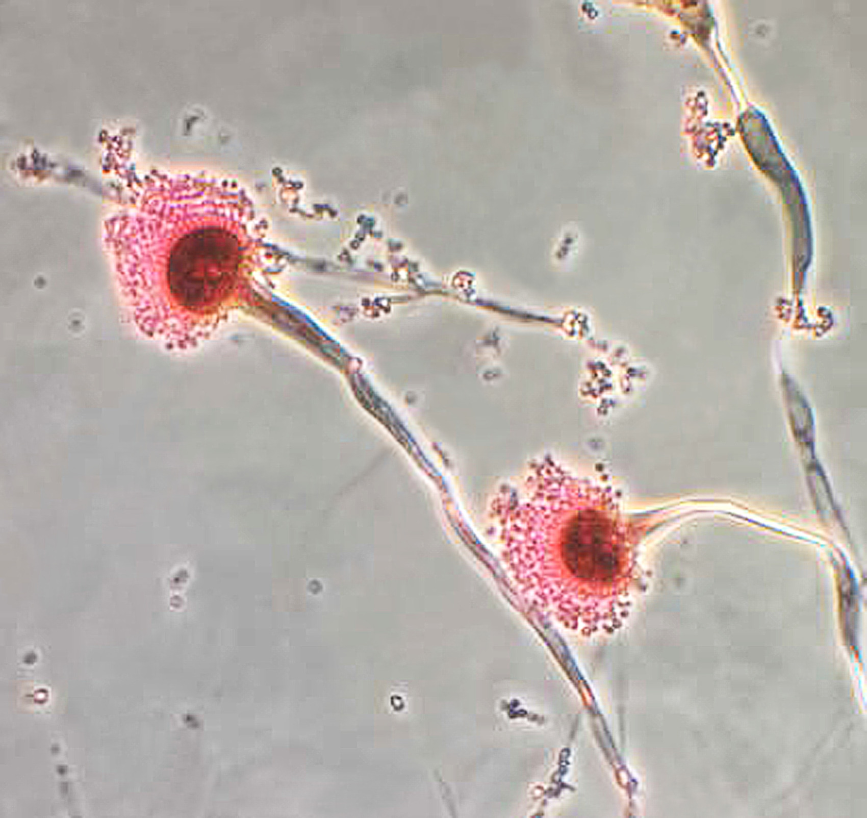 Aspergillus fumigatus Fuente: Public Health Image Library CDC