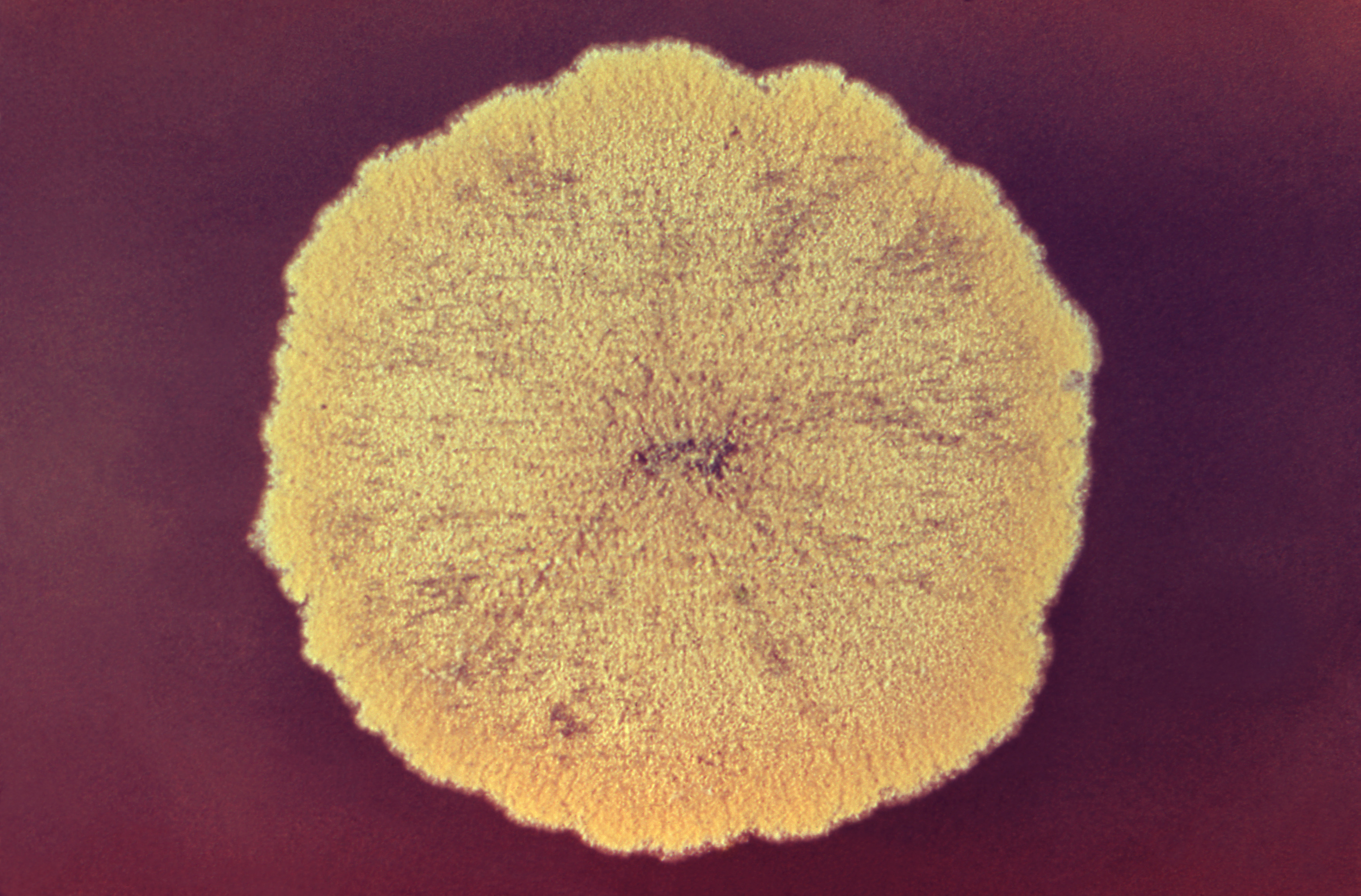 Aspergillus glaucus Fuente: Public Health Image Library CDC