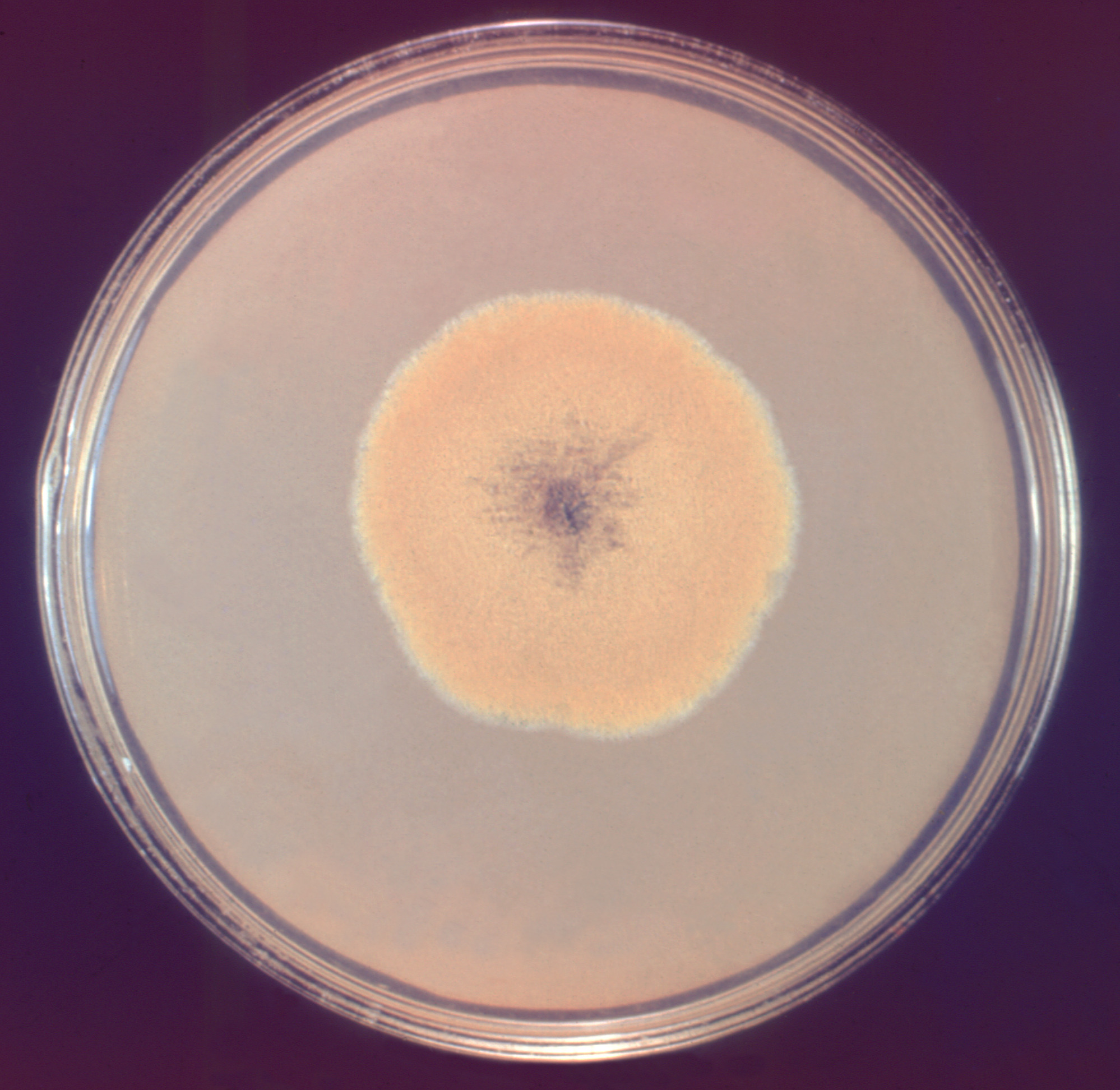 Aspergillus glaucus Fuente: Public Health Image Library CDC