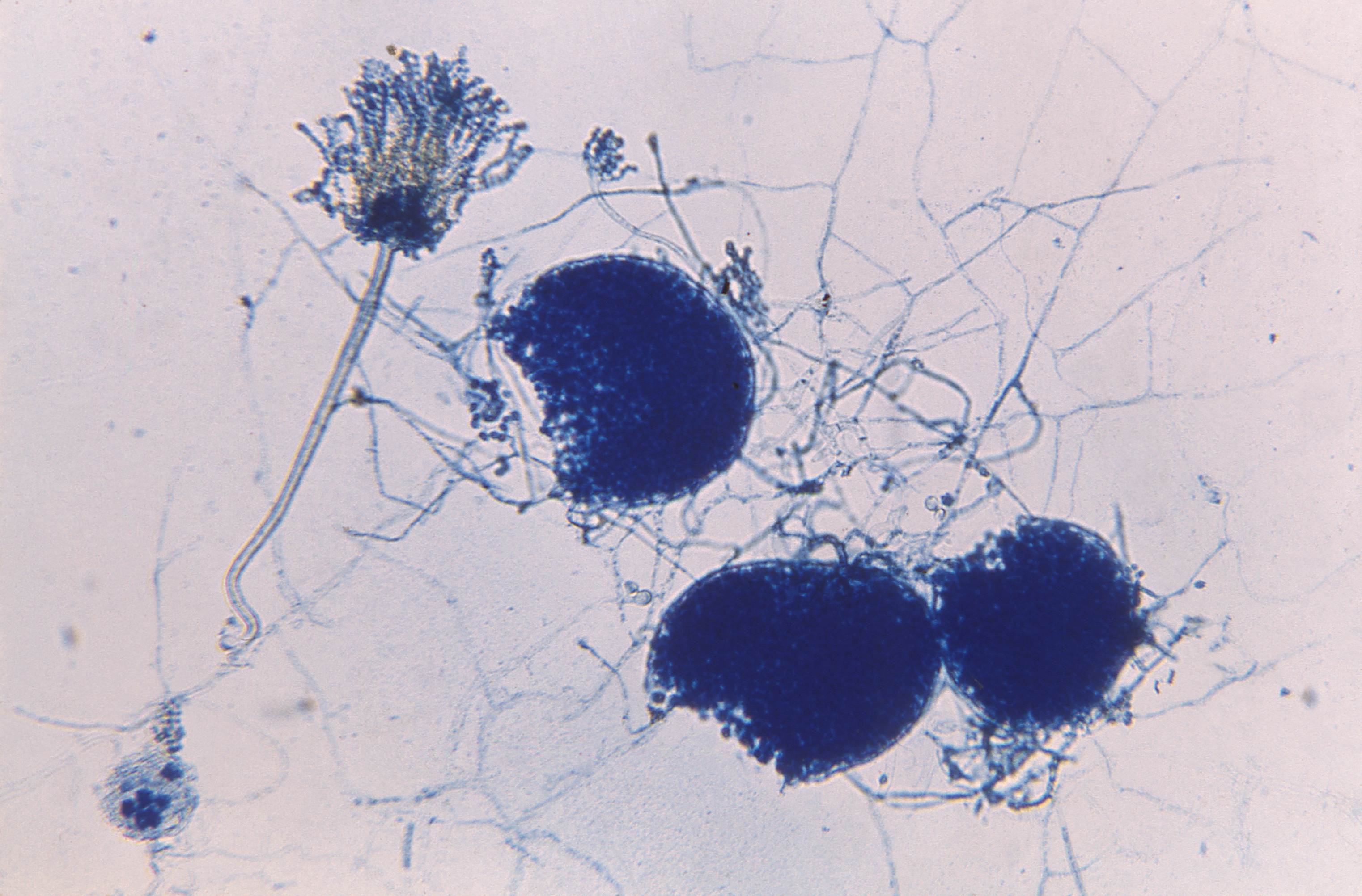 Aspergillus glaucus Fuente: Public Health Image Library CDC