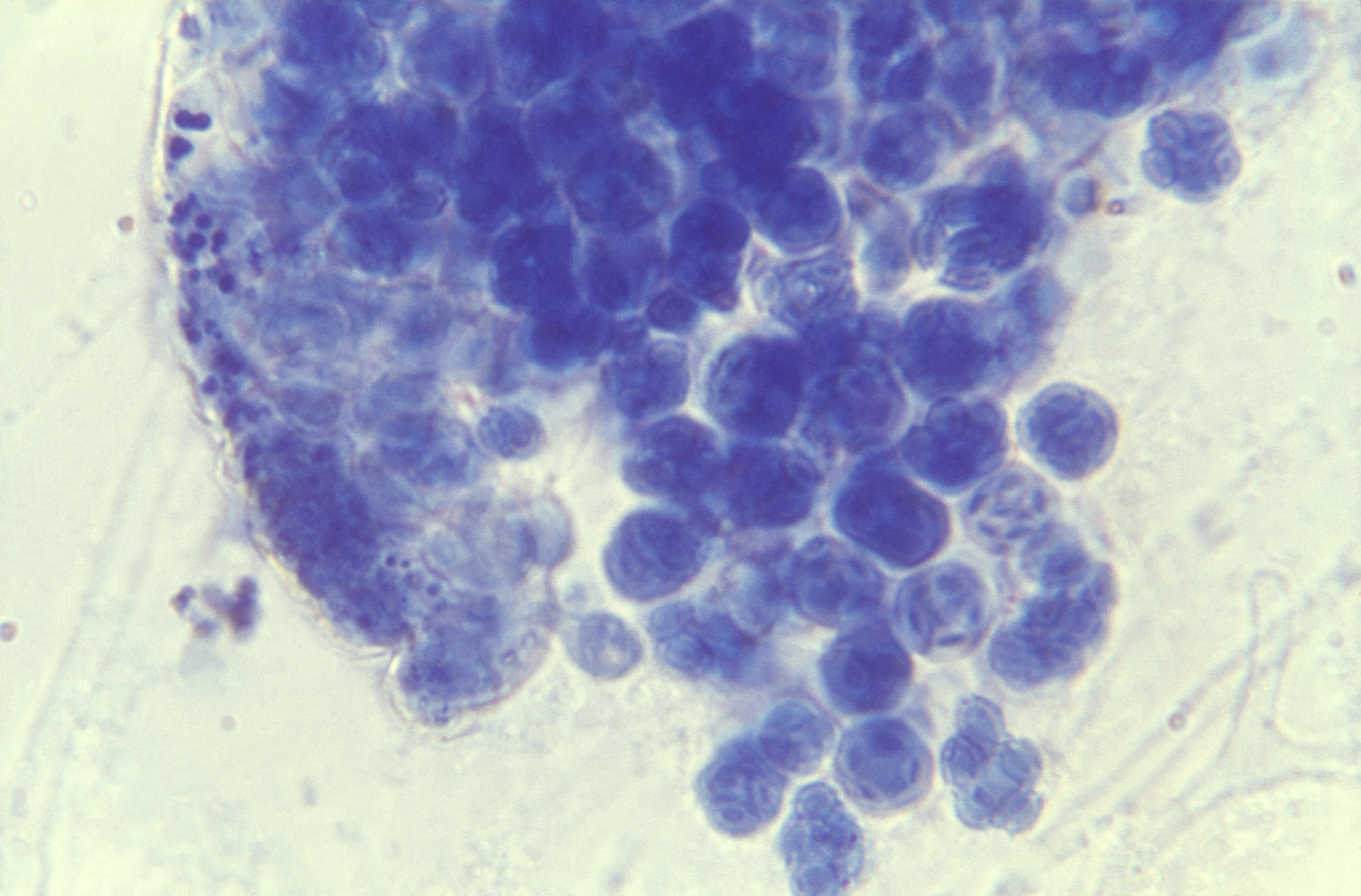 Aspergillus glaucus Fuente: Public Health Image Library CDC