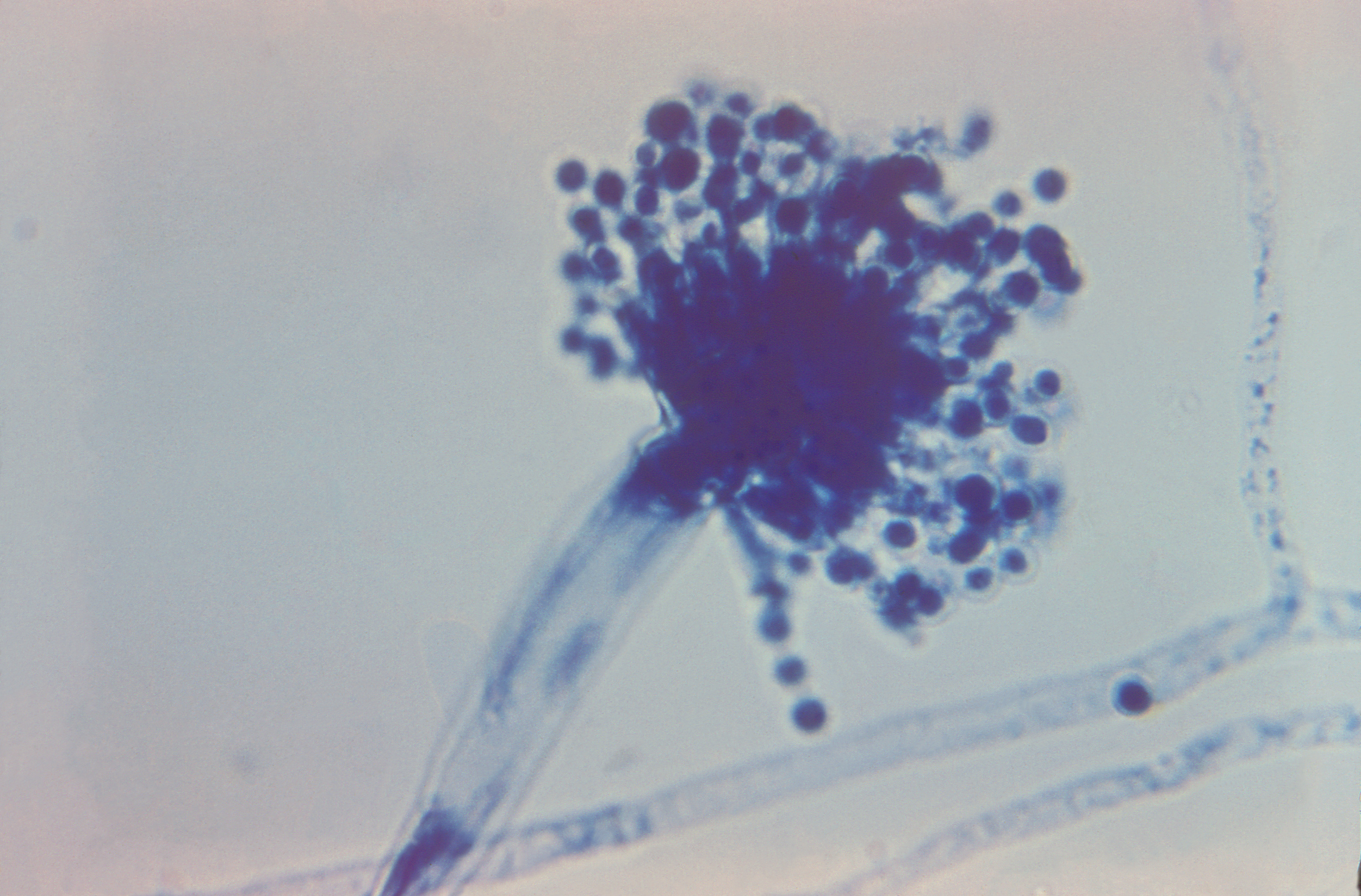 Aspergillus glaucus Fuente: Public Health Image Library CDC