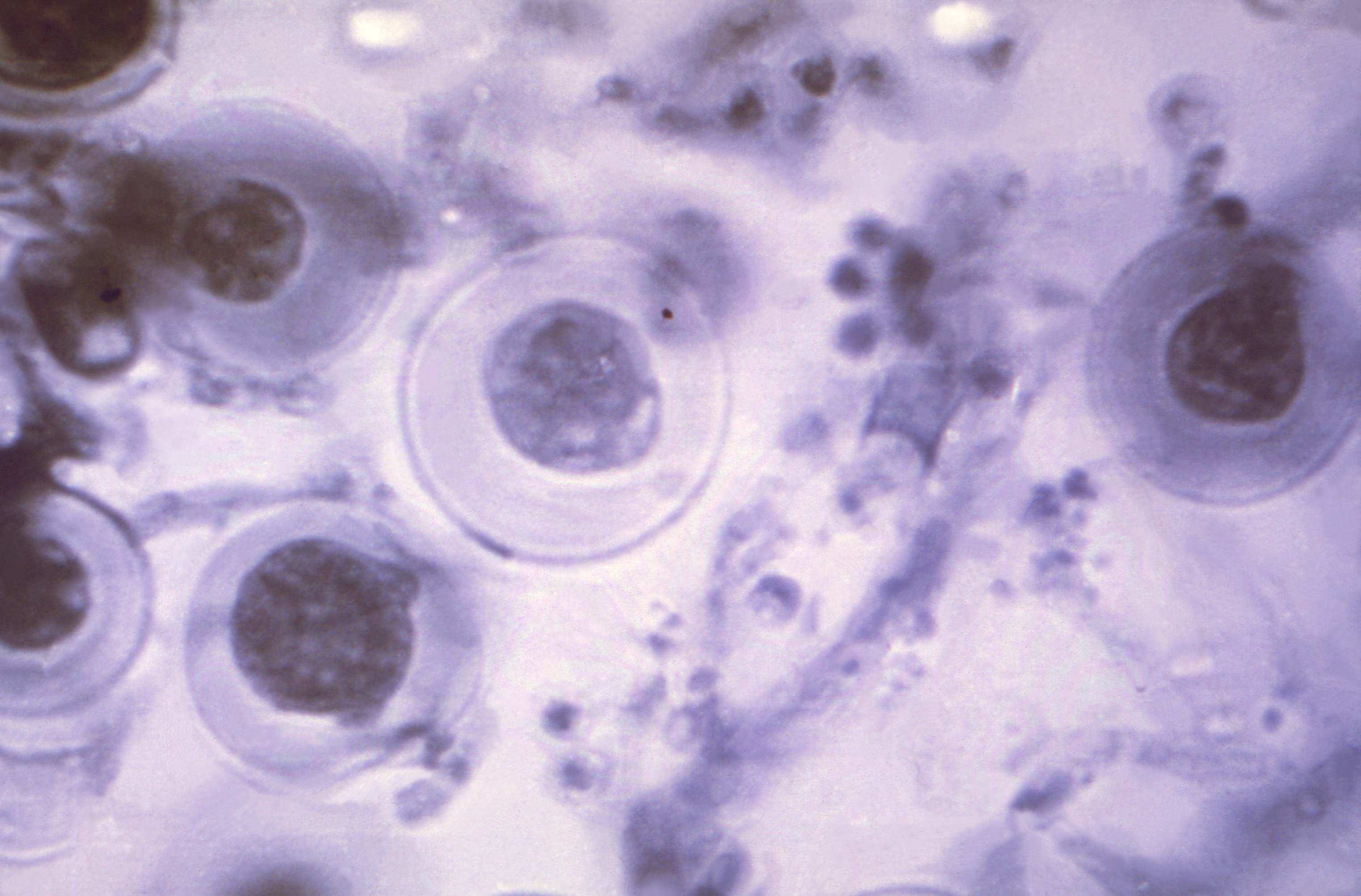 Aspergillus nidulans Fuente: Public Health Image Library CDC