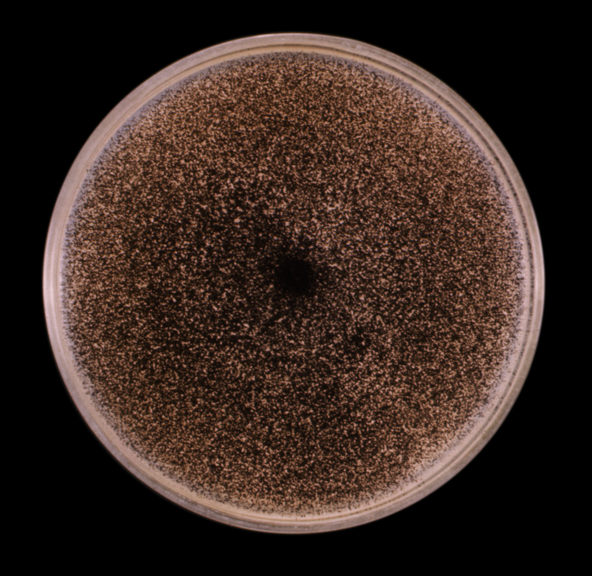 Aspergillus niger Fuente: Public Health Image Library CDC