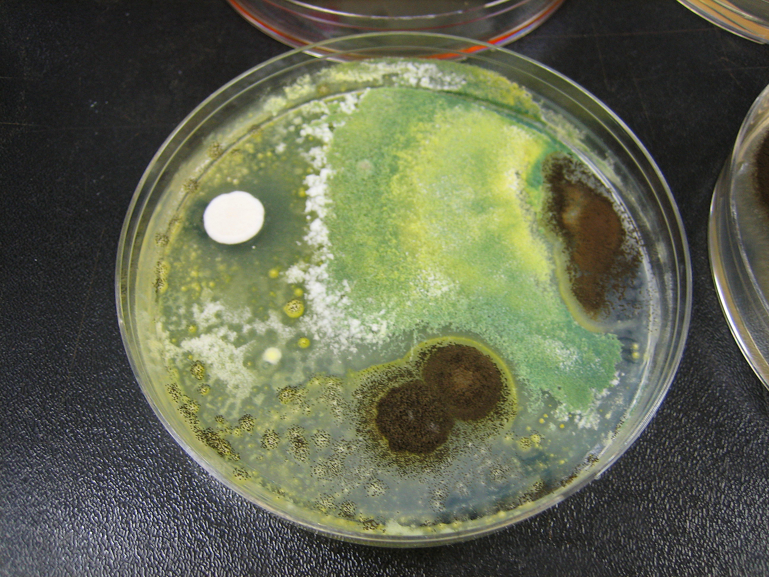 Aspergillus niger Fuente: Public Health Image Library CDC 