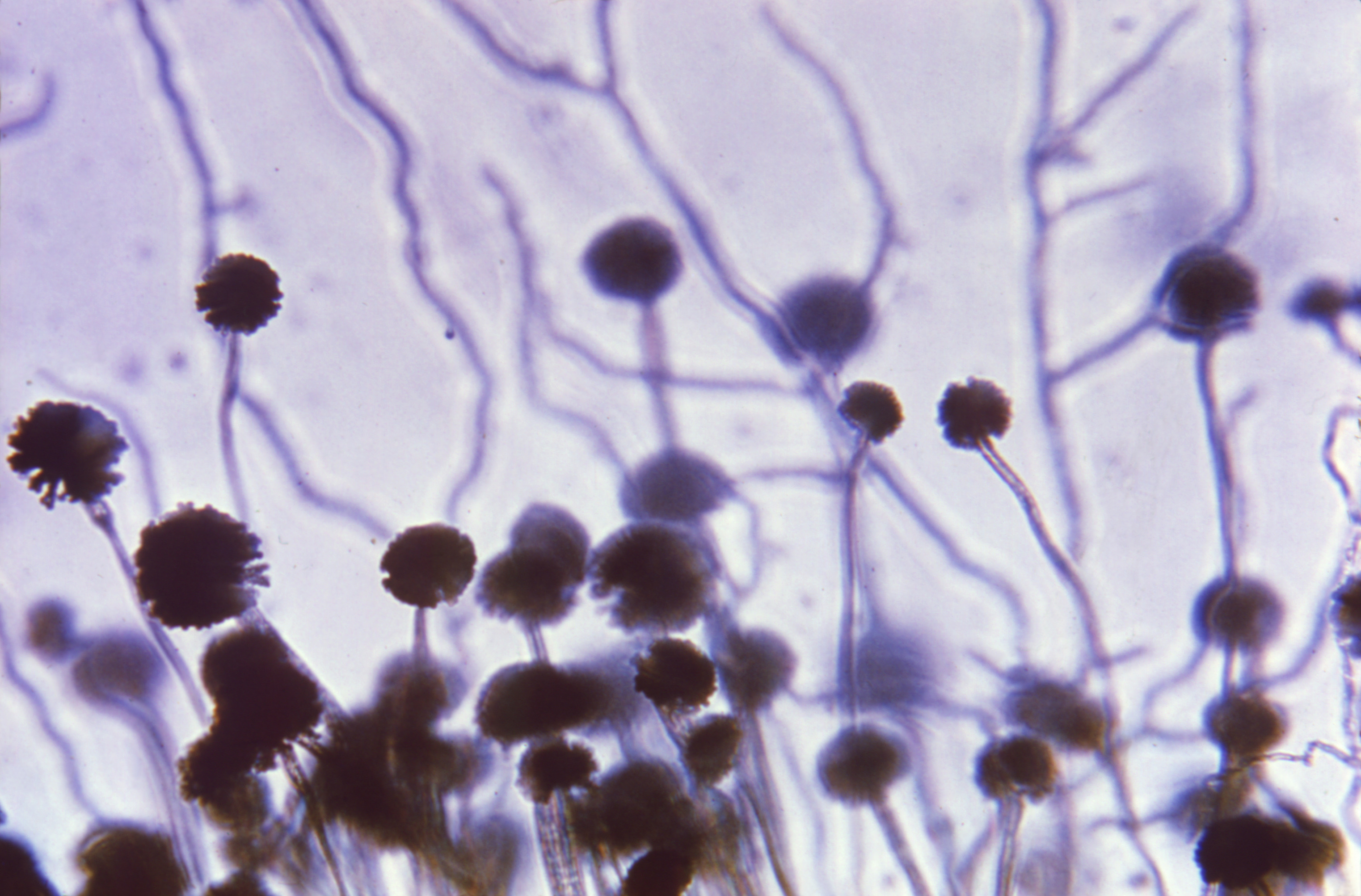 Aspergillus niger Fuente: Public Health Image Library CDC