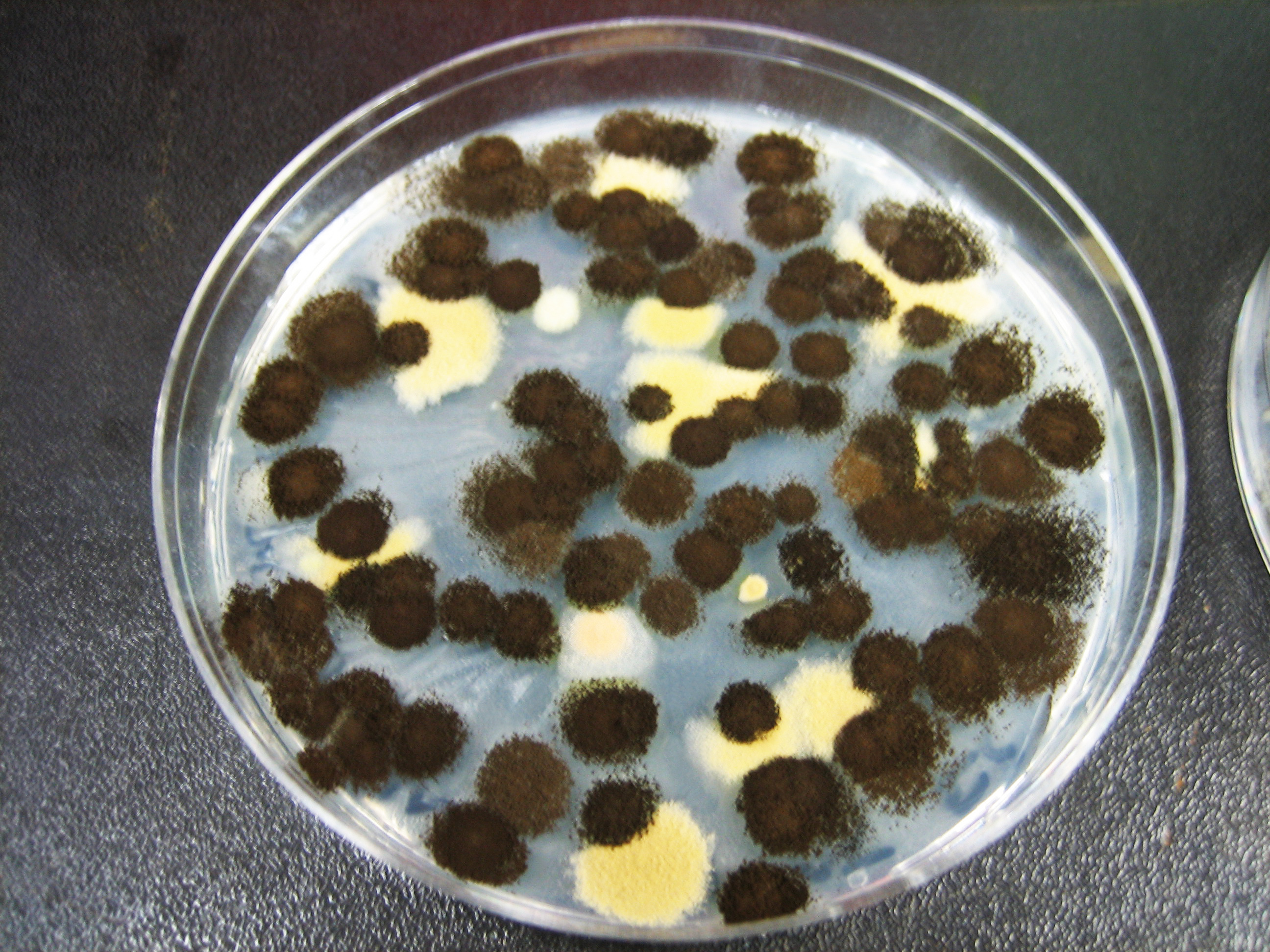 Aspergillus niger Fuente: Public Health Image Library CDC