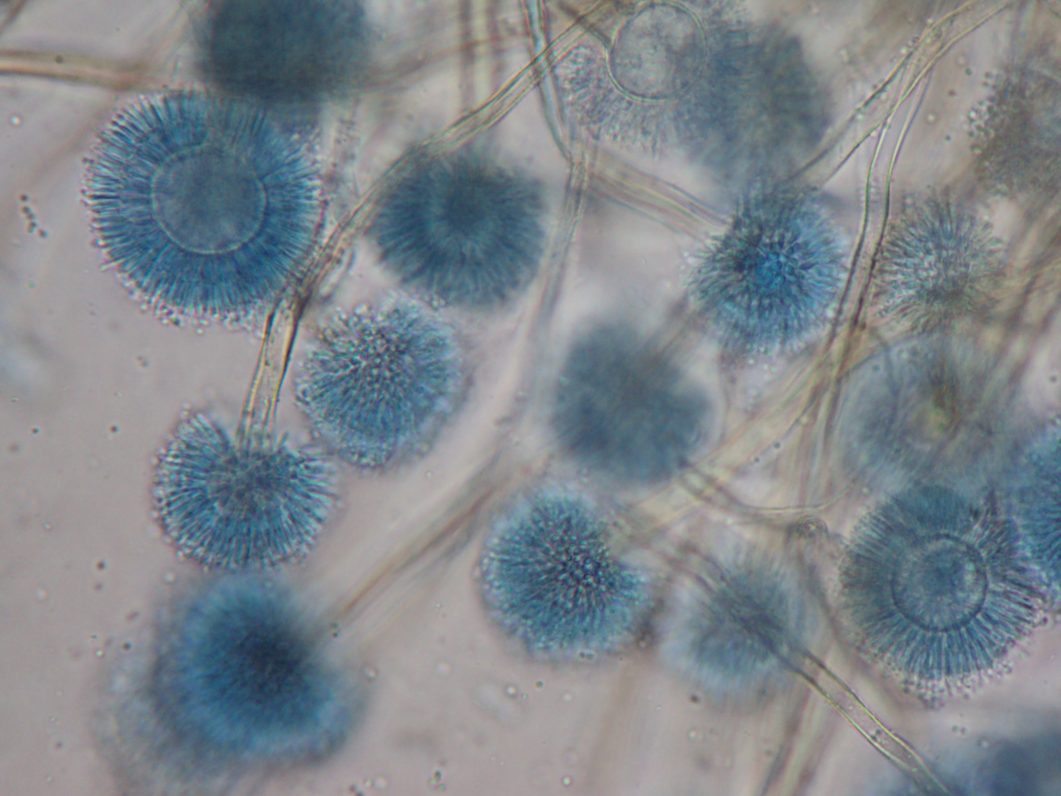 Aspergillus secciÃ³n Circumdati Fuente: Public Health Image Library CDC