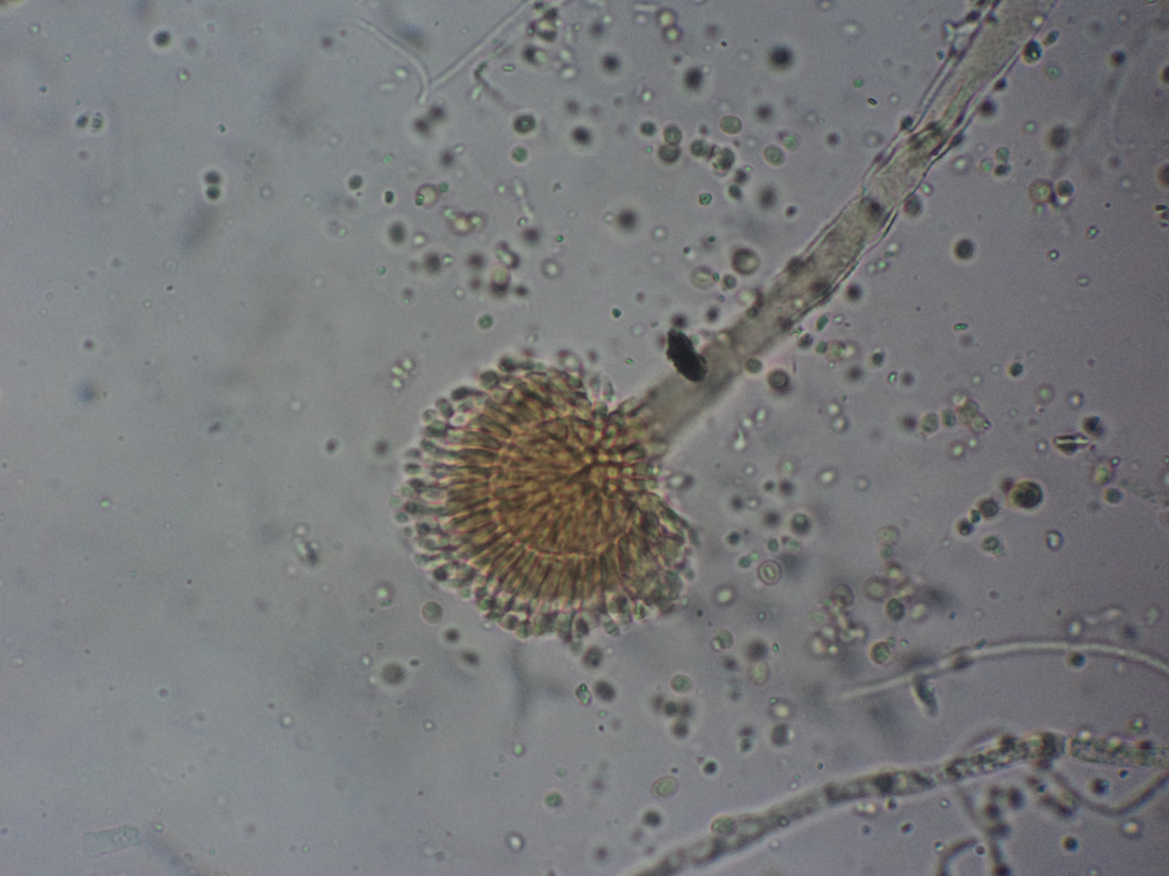 Aspergillus secciÃ³n Flavi Fuente: Public Health Image Library CDC