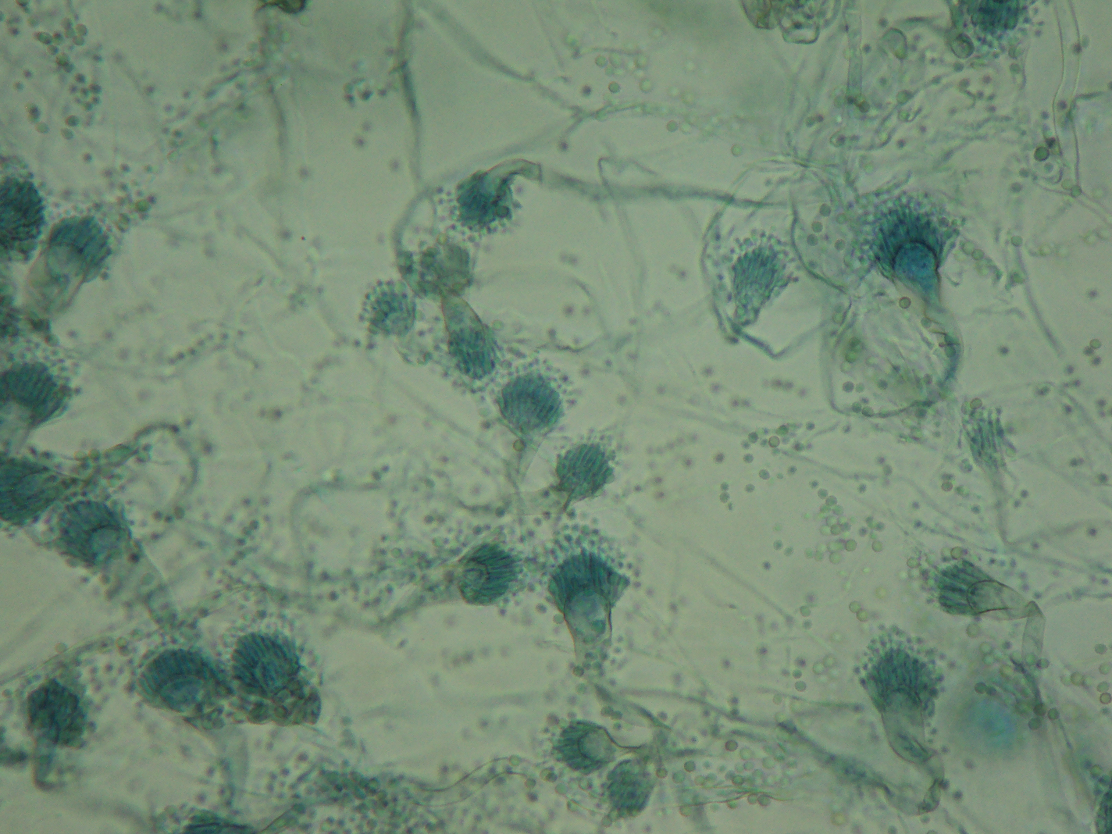 Aspergillus secciÃ³n Fumigati