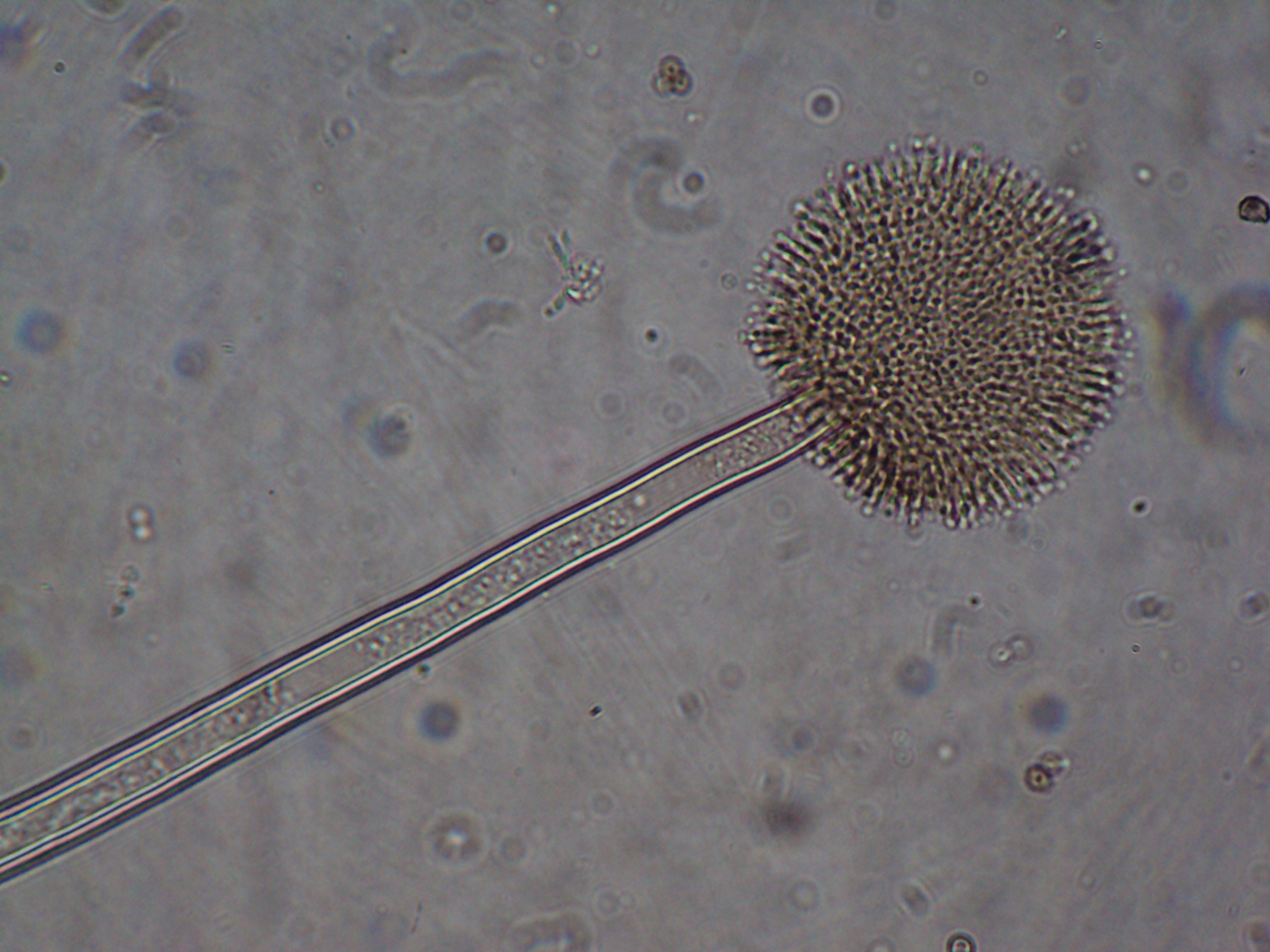 Aspergillus secciÃ³n Nigri Fuente: Public Health Image Library CDC