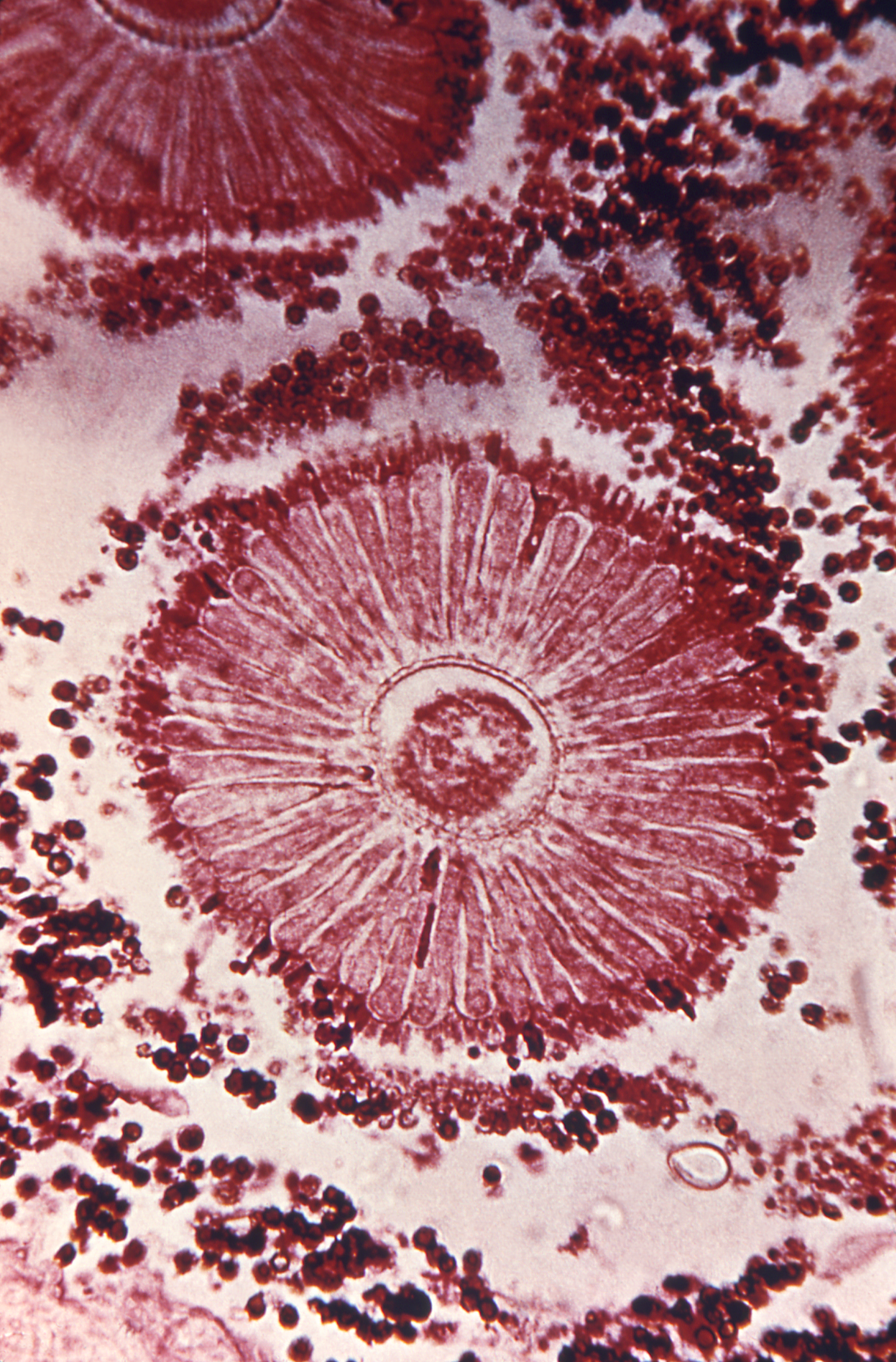 AsperAspergillus sp. Fuente: Public Health Image Library CDC