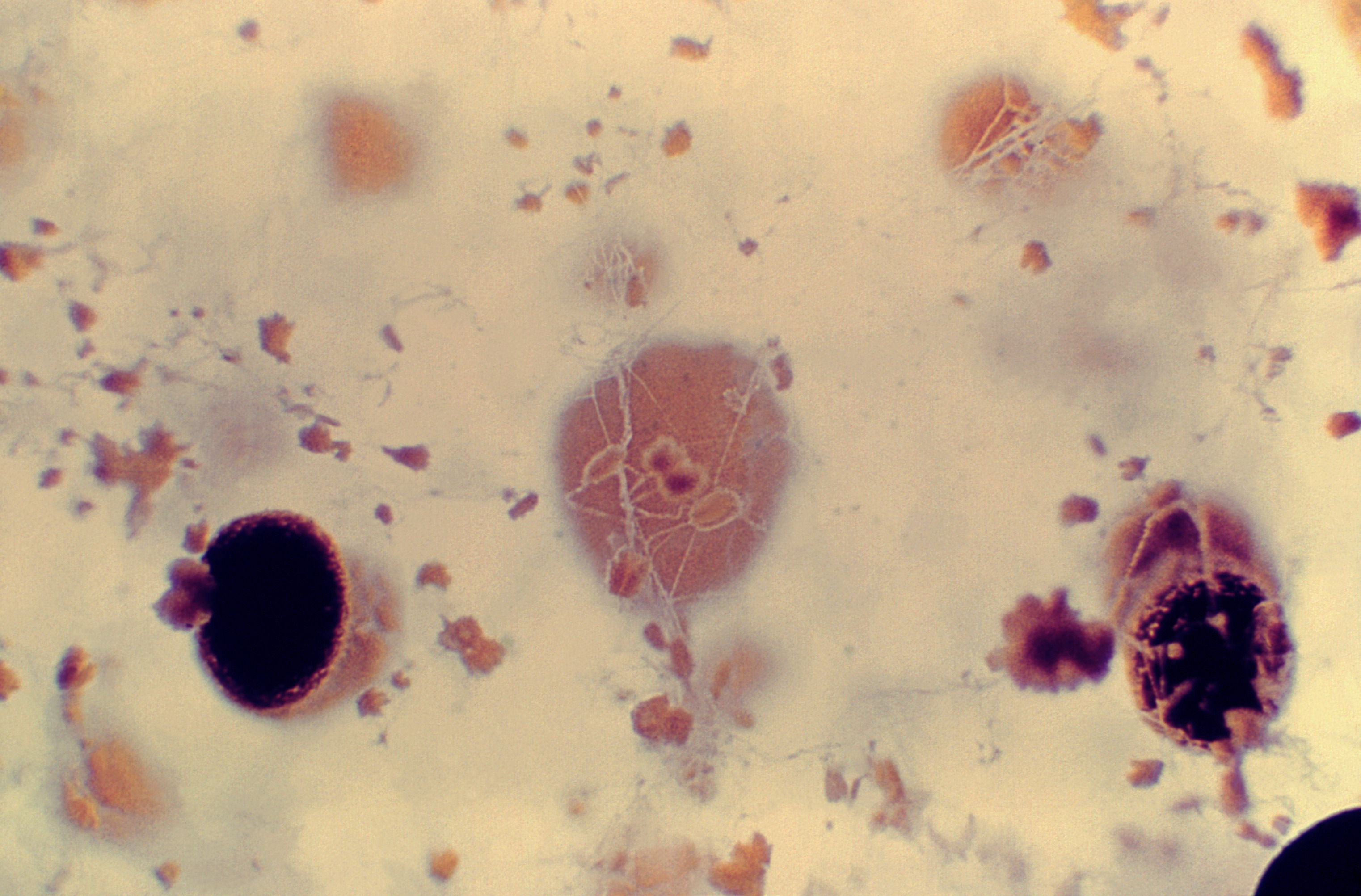 Aspergillus-alliaceus Fuente: Public Health Image Library CDC