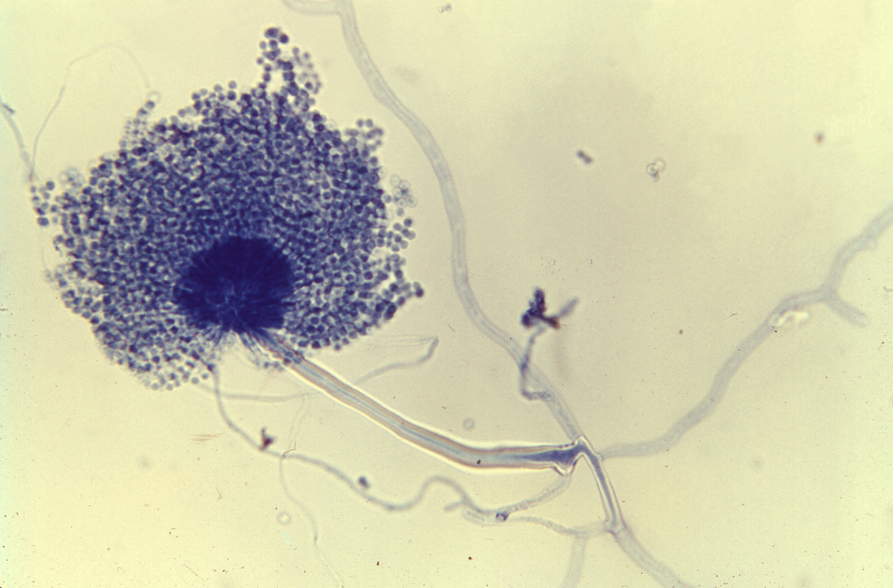 Aspergillus-alliaceus 