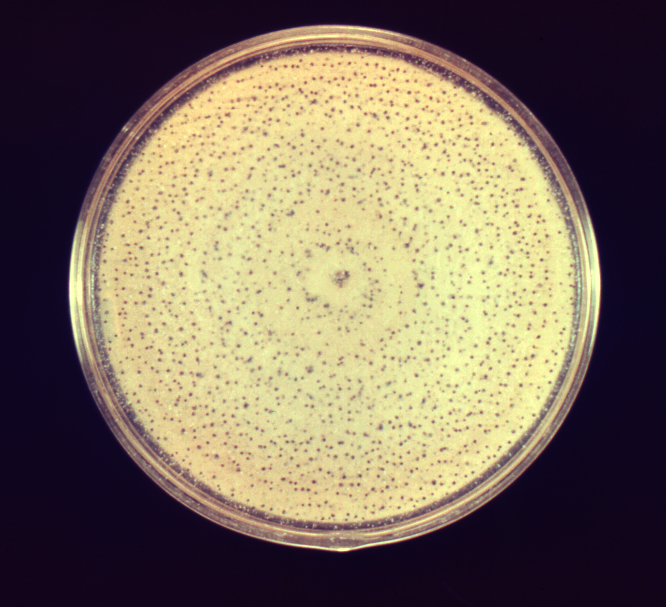 Aspergillus alliaceus Fuente: Public Health Image Library CDC