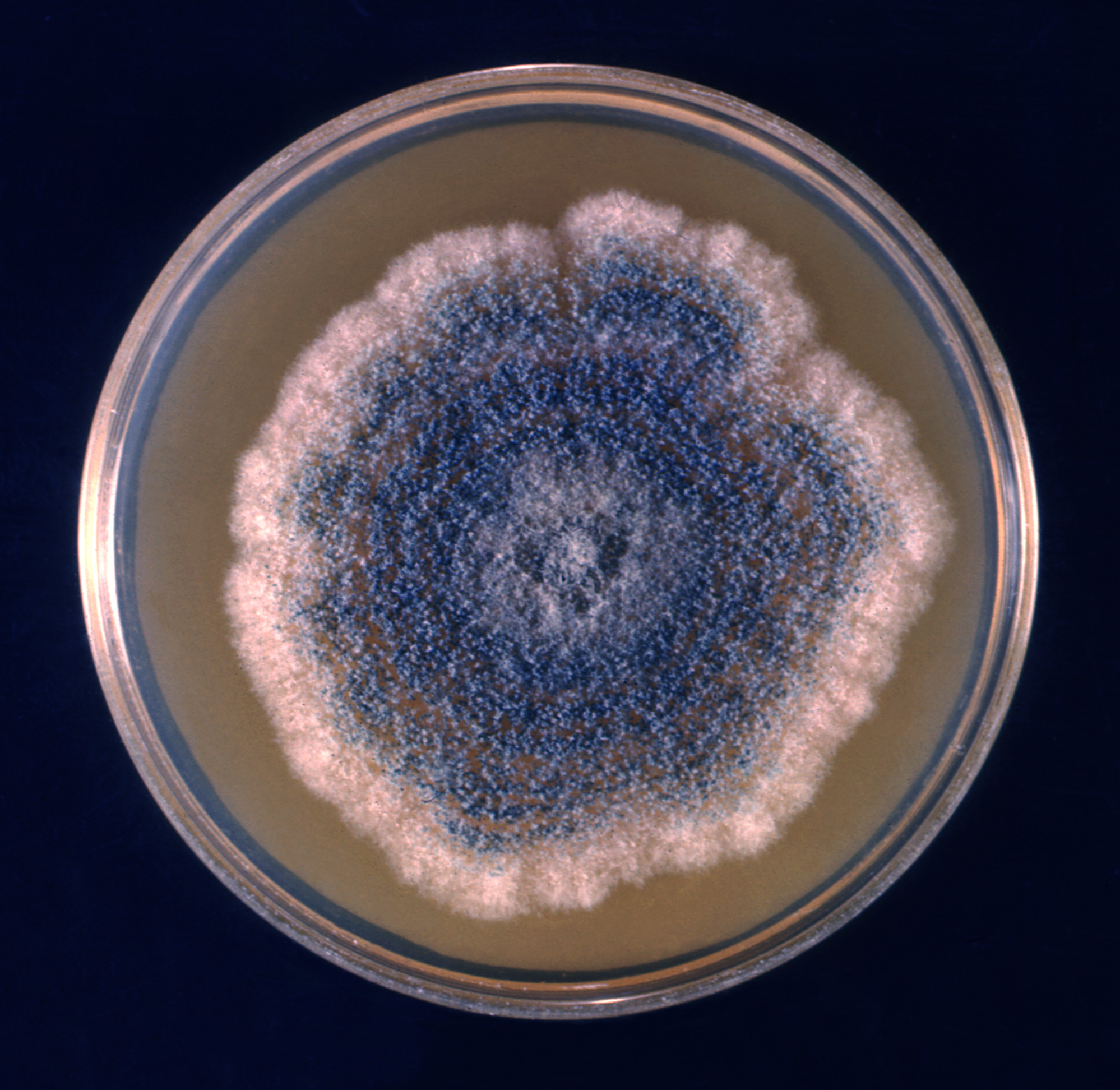 Aspergillus clavatus Fuente: Public Health Image Library CDC