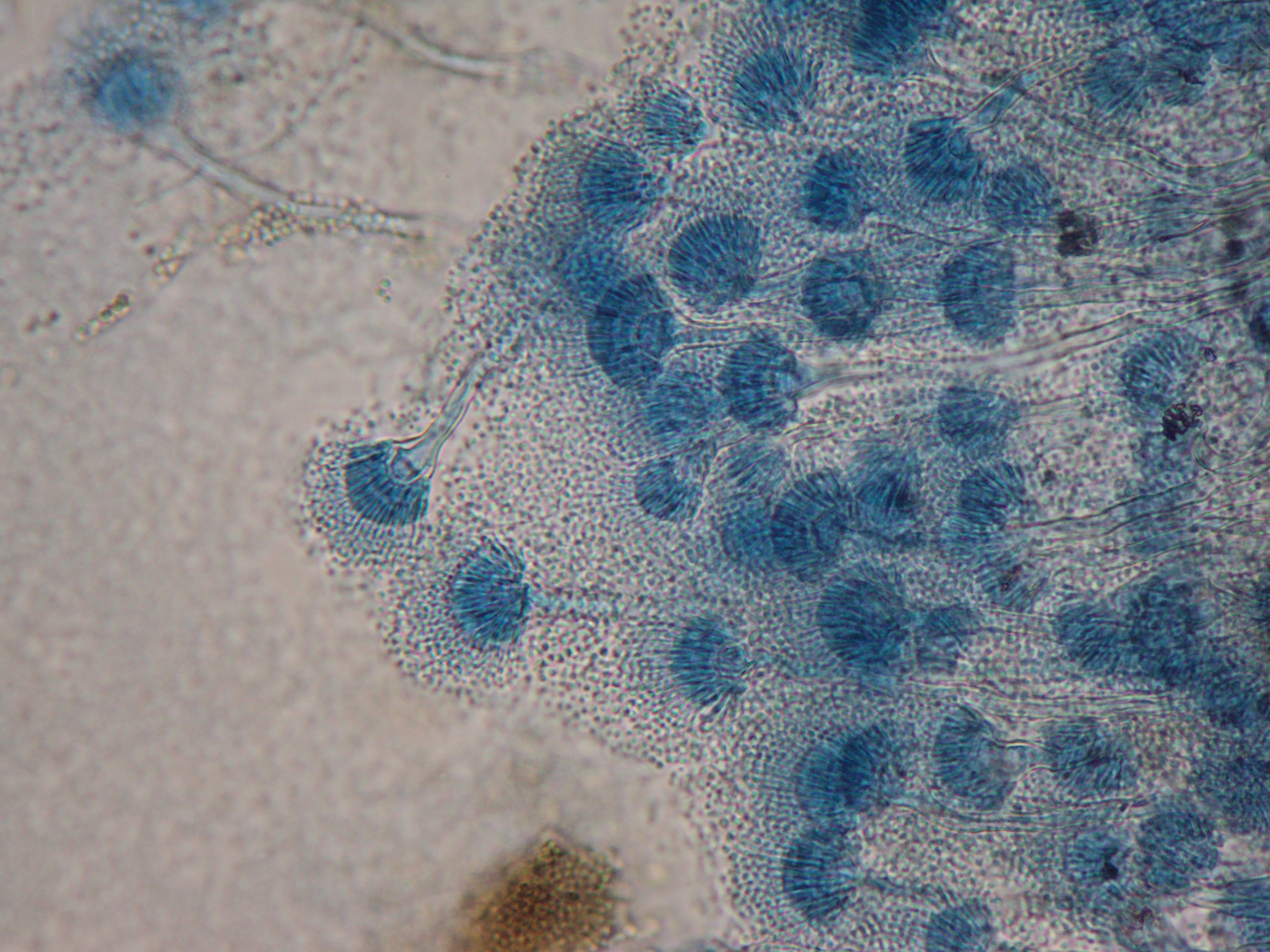 Aspergillus-secciÃ³n-Terrei Fuente: Public Health Image Library CDC