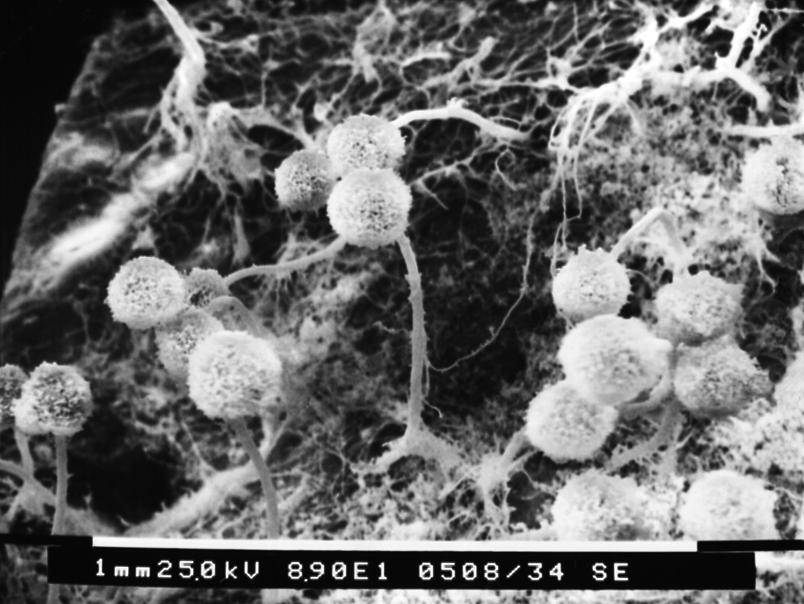 Aspergillus-sp. Fuente: Public Health Image Library CDC