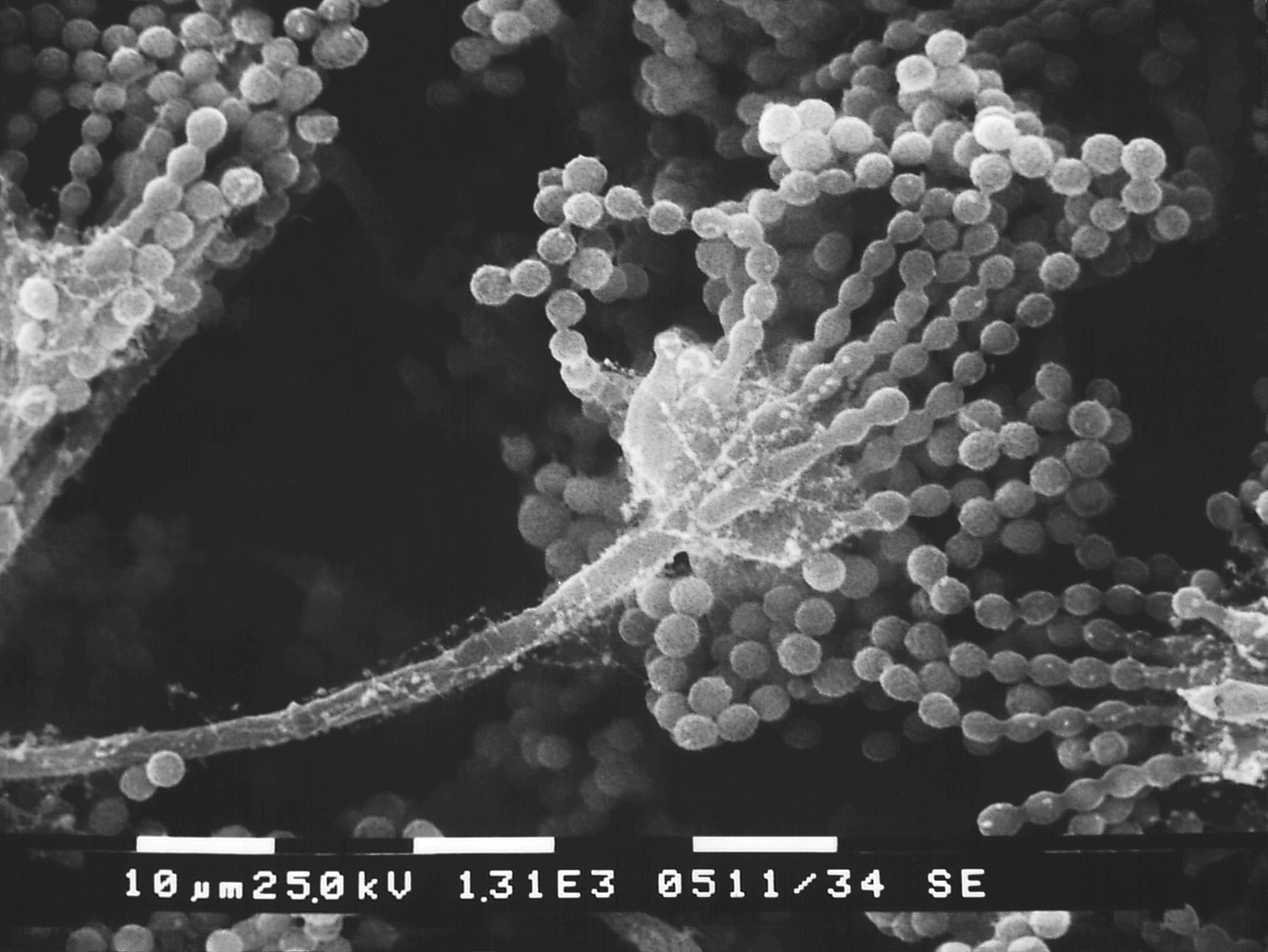 Aspergillus-sp. Fuente: Public Health Image Library CDC