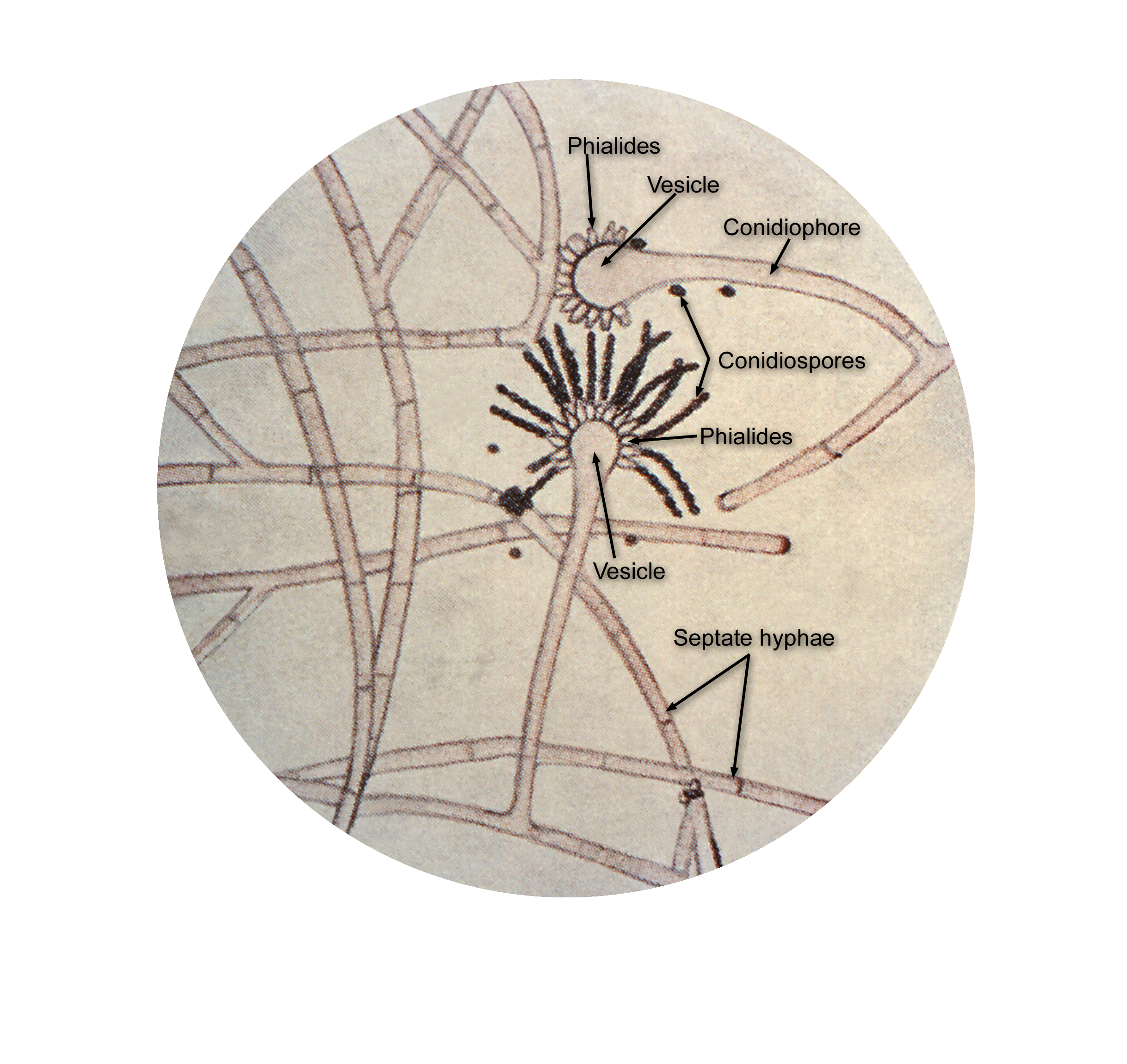 Aspergillus-sp. Fuente: Public Health Image Library CDC