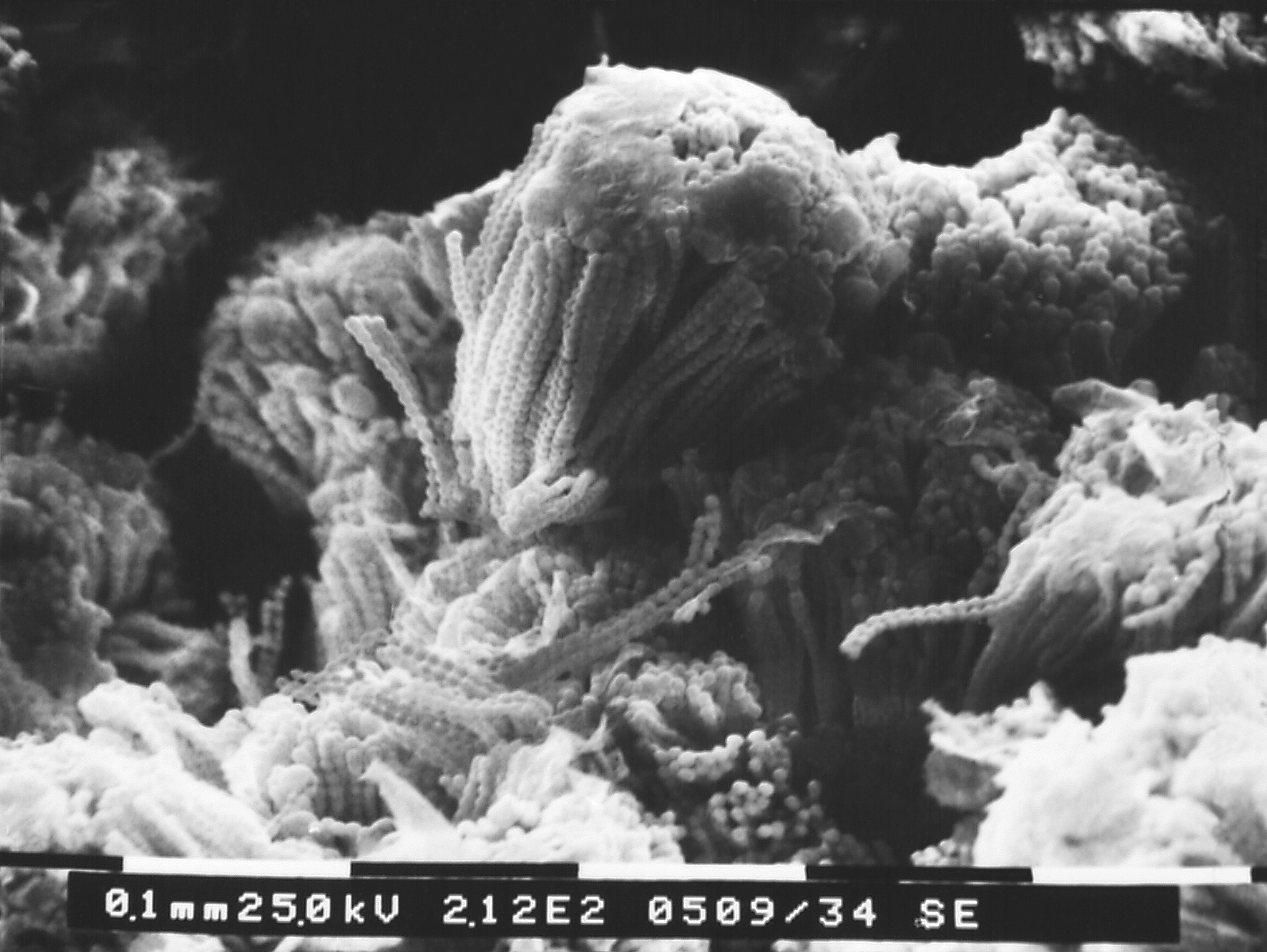 Aspergillus-sp. Fuente: Public Health Image Library CDC