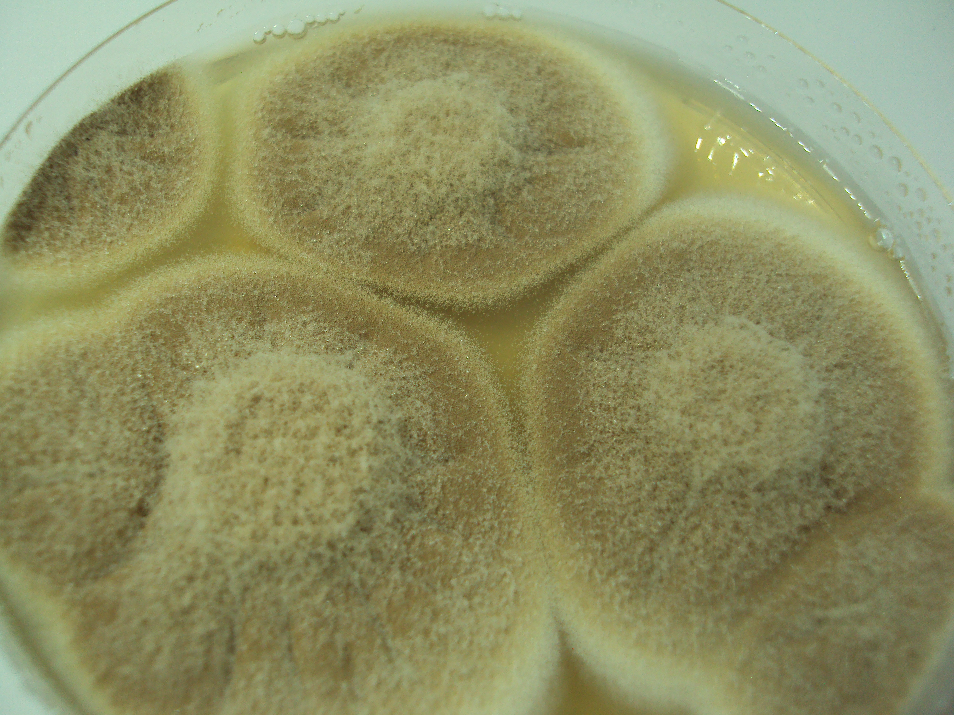 Cultivo Aspergillus secciÃ³n Terrei Fuente: Public Health Image Library CDC