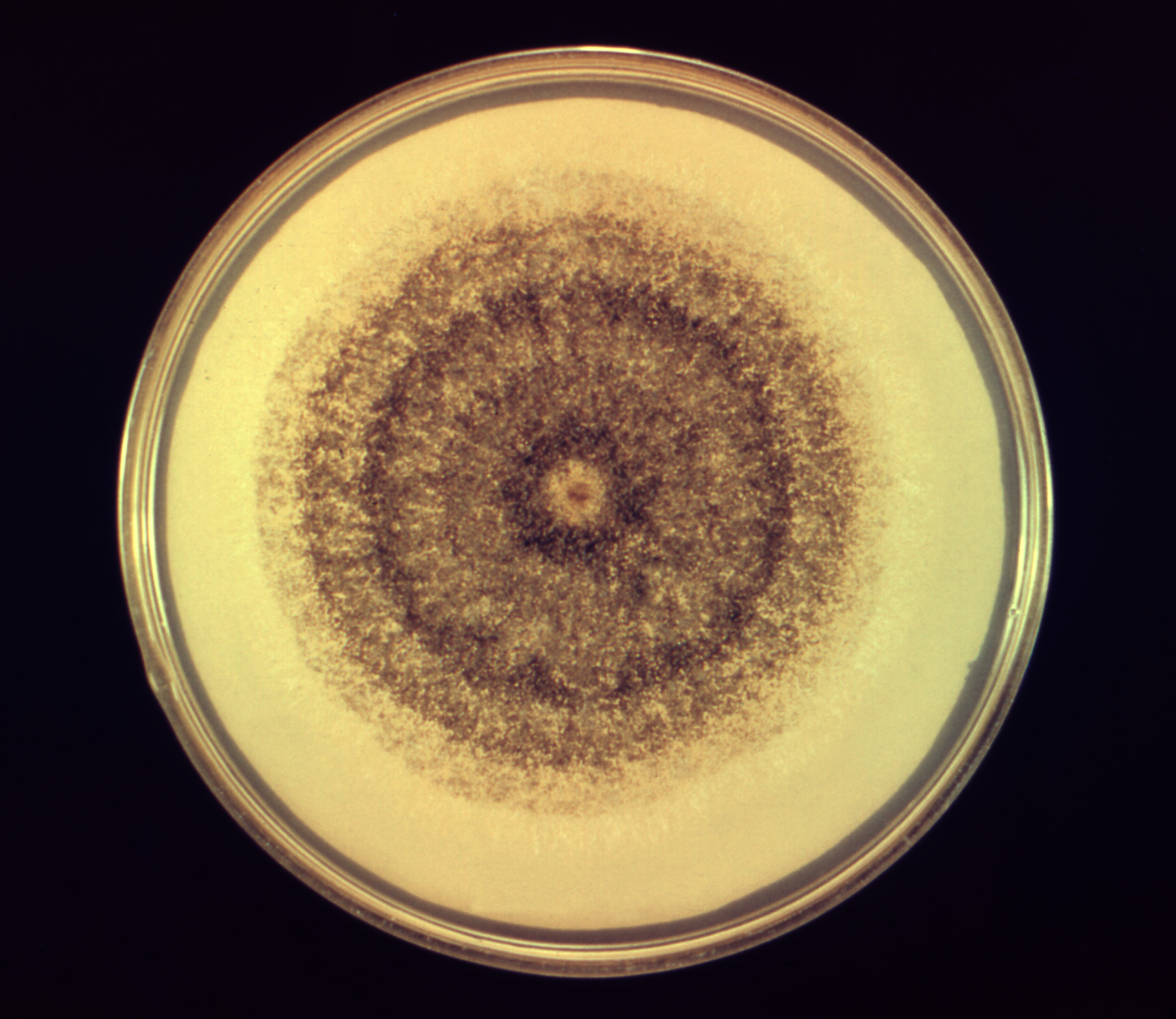 Aspergillus-tamarii-19337 Fuente: Public Health Image Library CDC