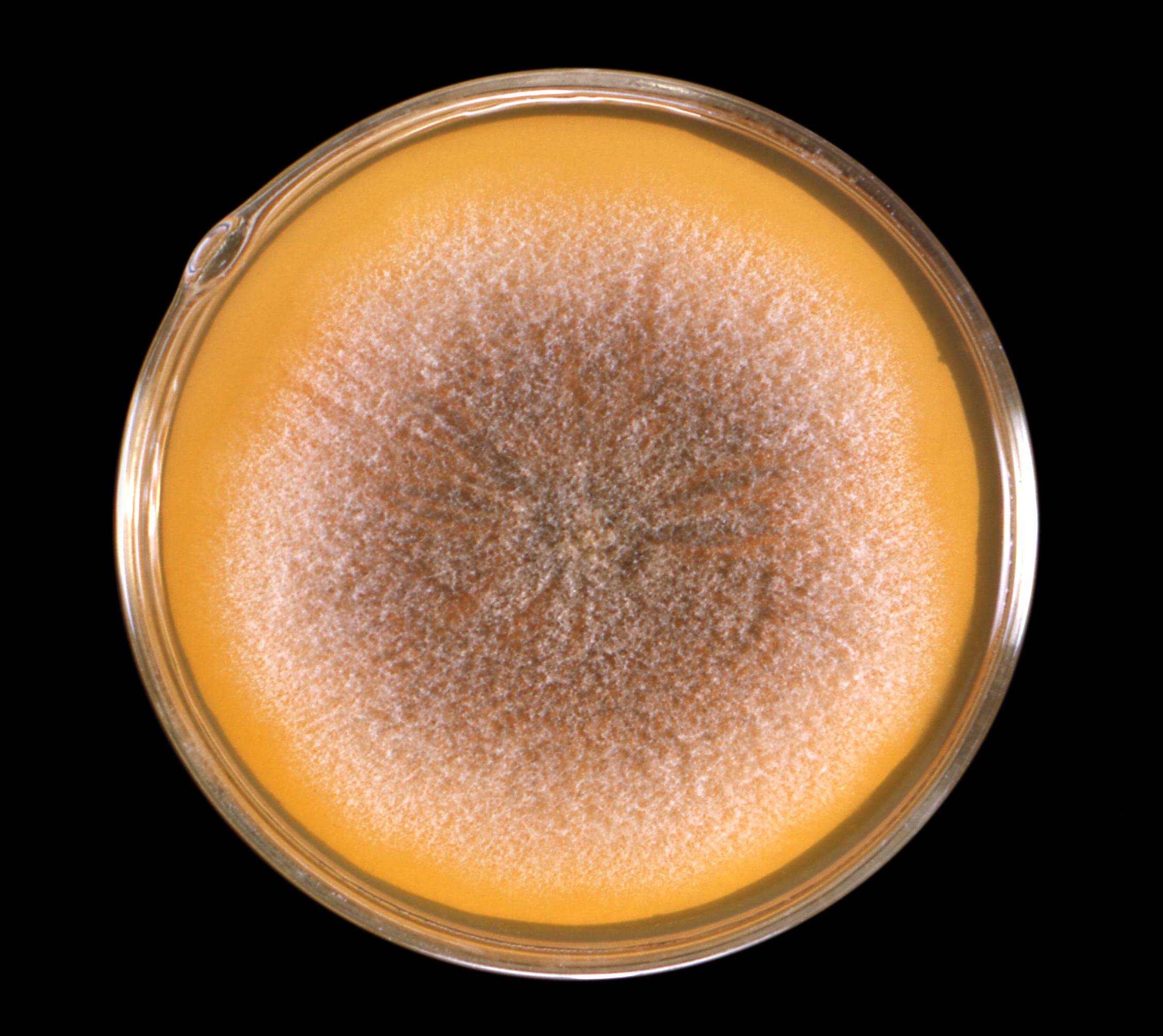 aspergillus-terreus-19286 Fuente: Public Health Image Library CDC