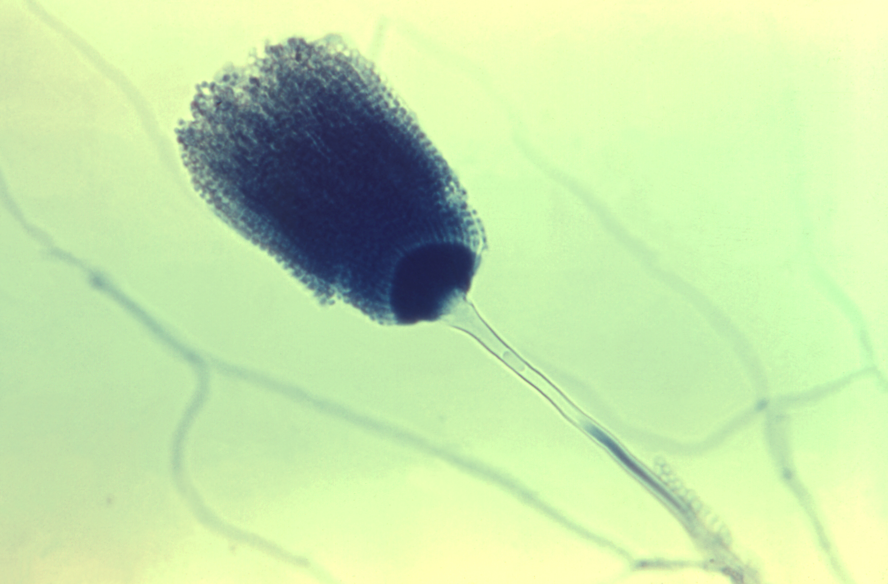 Aspergillus-terreus-19338 Fuente: Public Health Image Library CDC