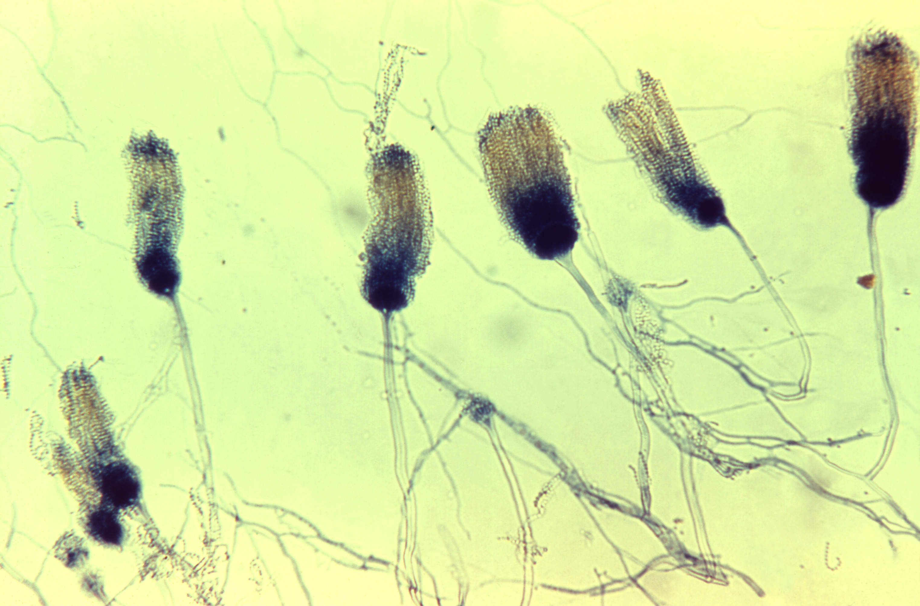 aspergillus-terreus-19340