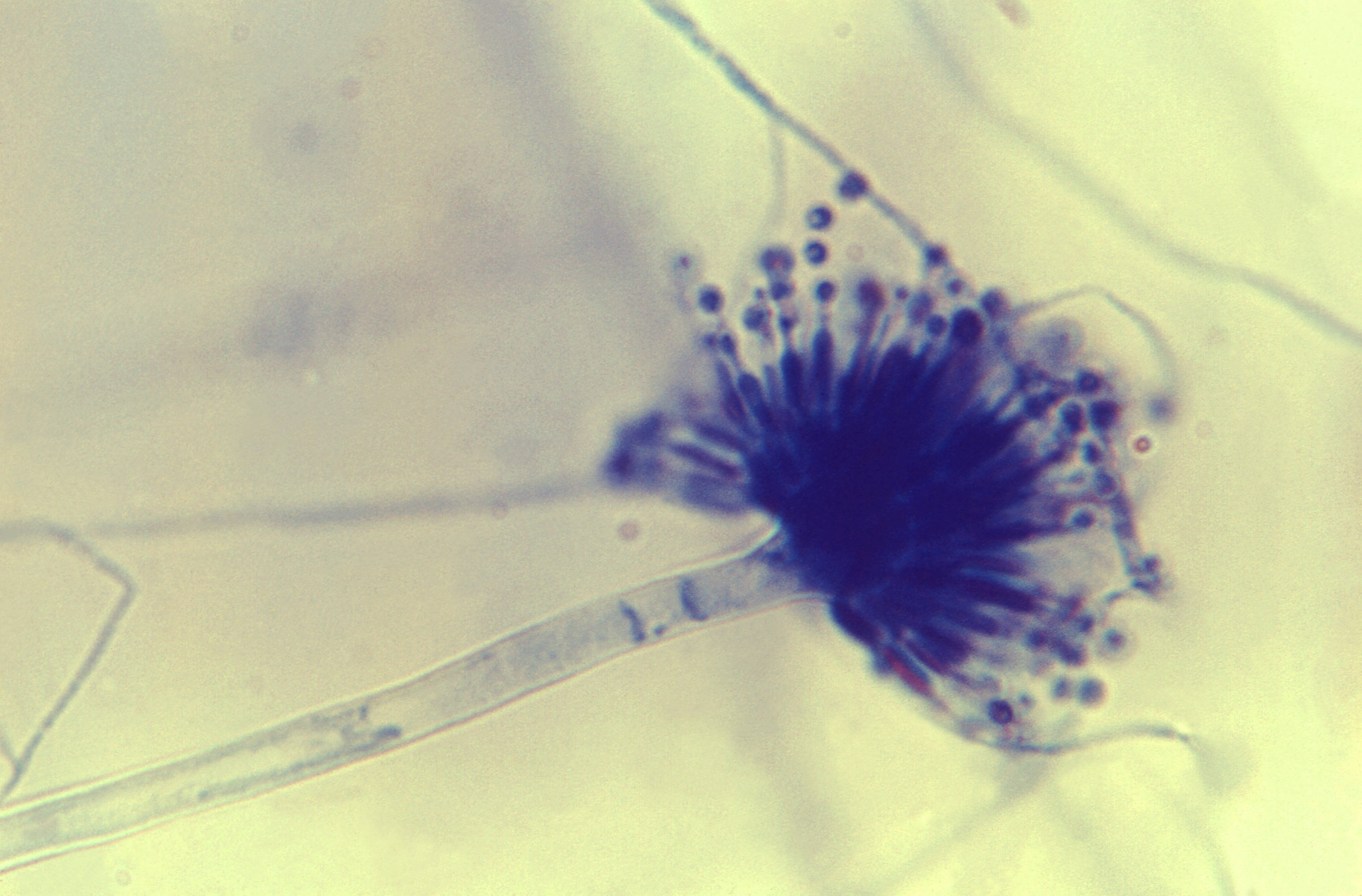 Aspergillus-versicolor-1928 Fuente: Public Health Image Library CDC