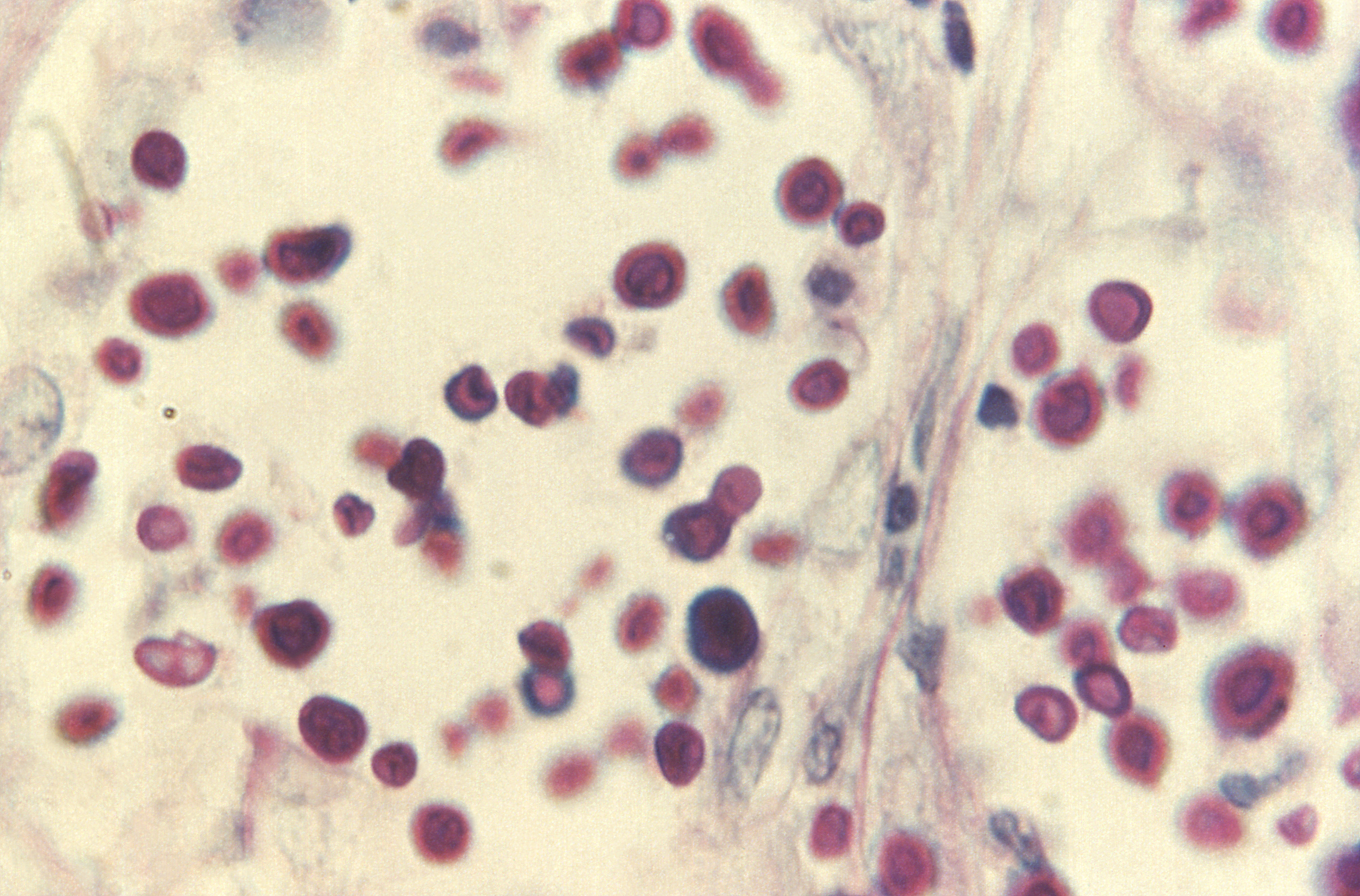 Cryptococcus_980X-tejido de hígado teñido con PAS Fuente: Public Health Image Library CDC